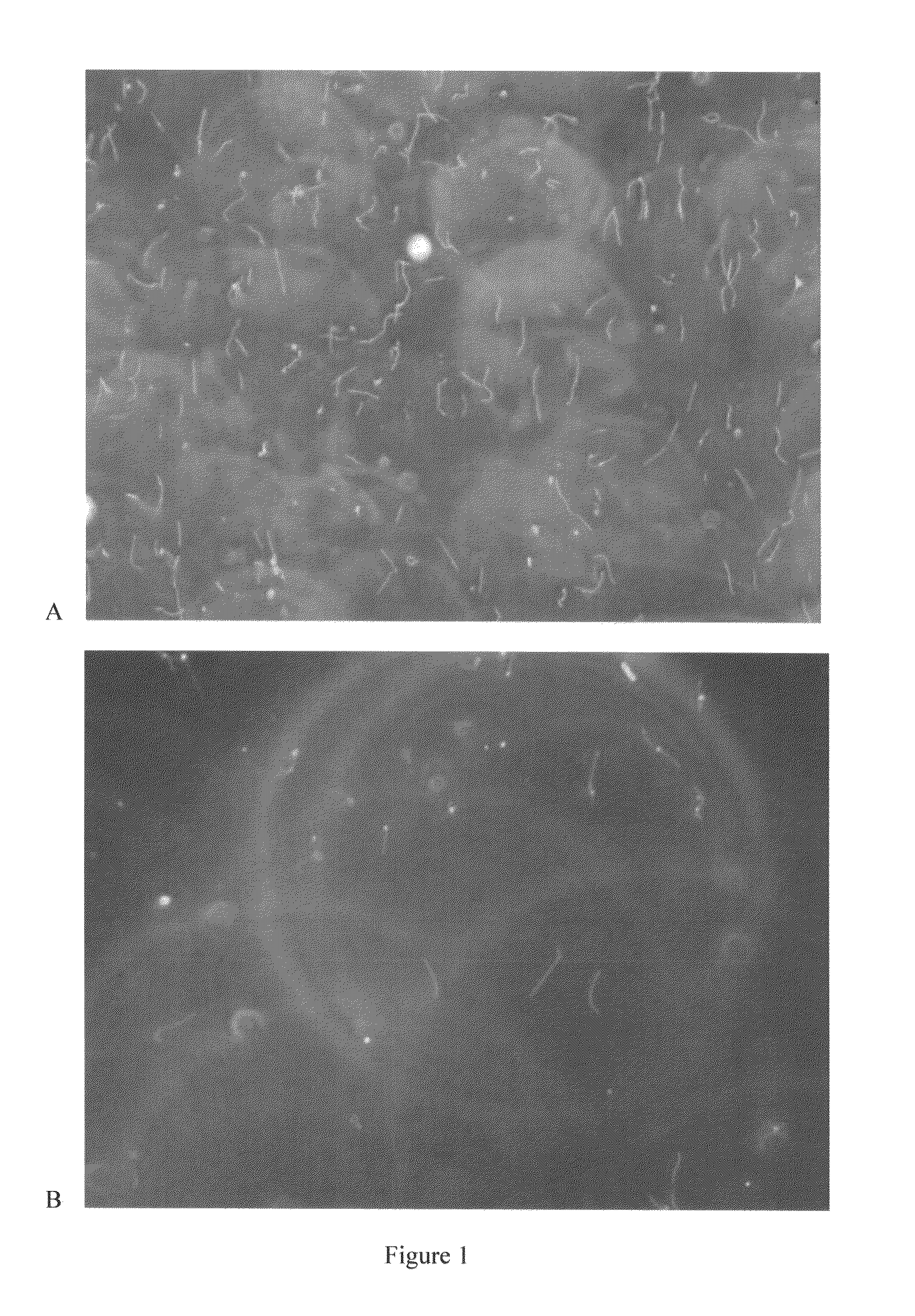 Compositions and methods for culturing spirochetes