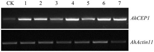 Application for peanut hairy-root strain in improvement of low-nitrogen resistance and high-salt resistance of peanuts