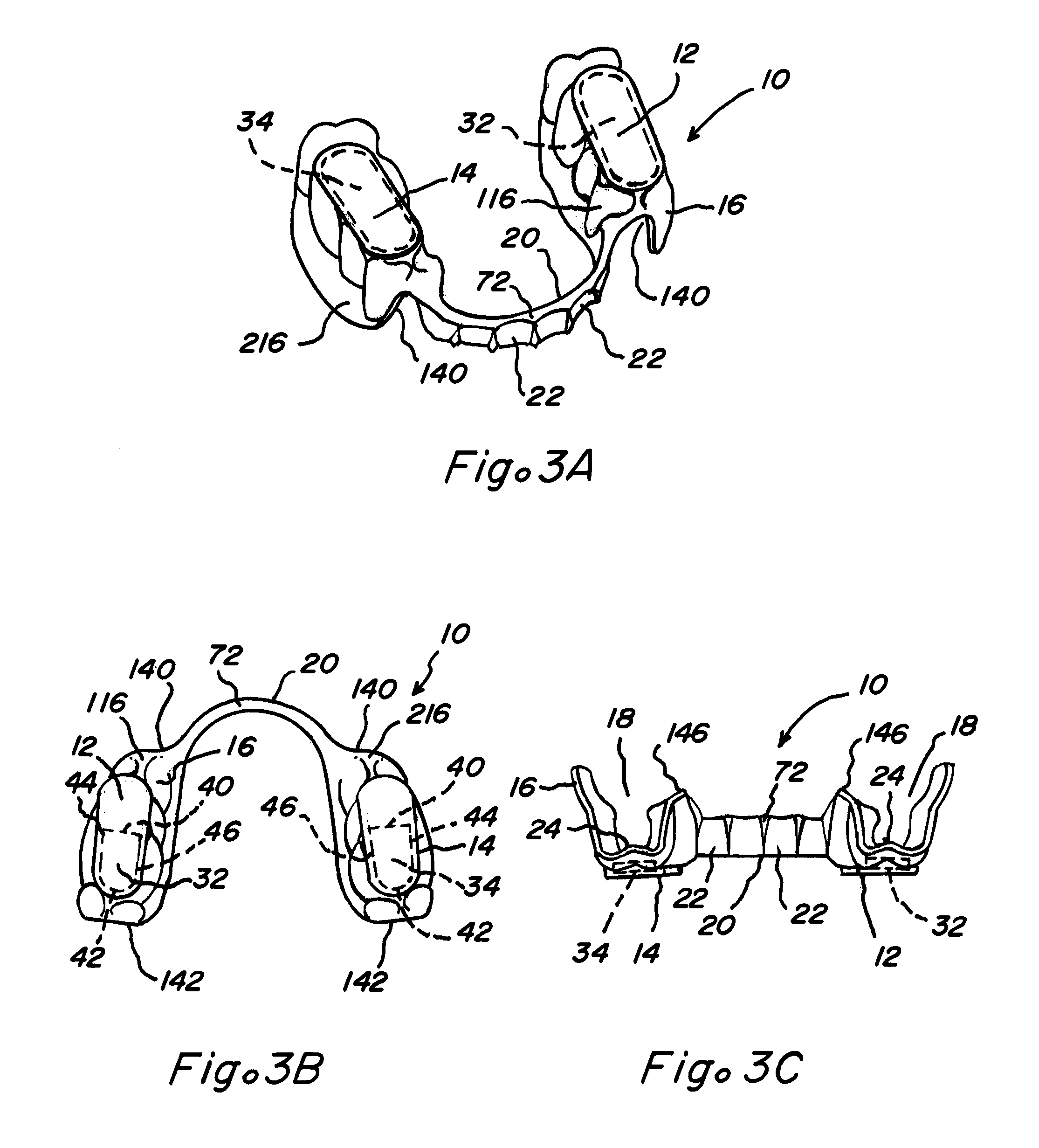 Composite oral appliances and methods for manufacture