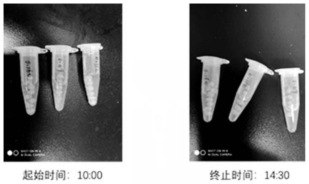 Oral capsule for intestinal flora transplantation and preparation method thereof