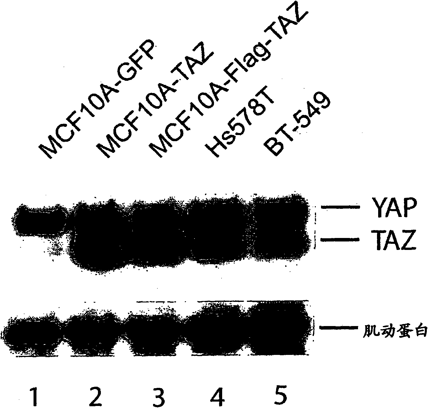 TAZ/WWTR1 for diagnosis and treatment of cancer