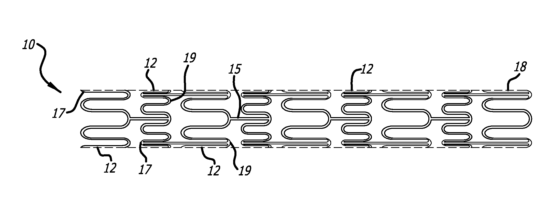 Stent Combined with a Biological Scaffold Seeded With Endothelial Cells