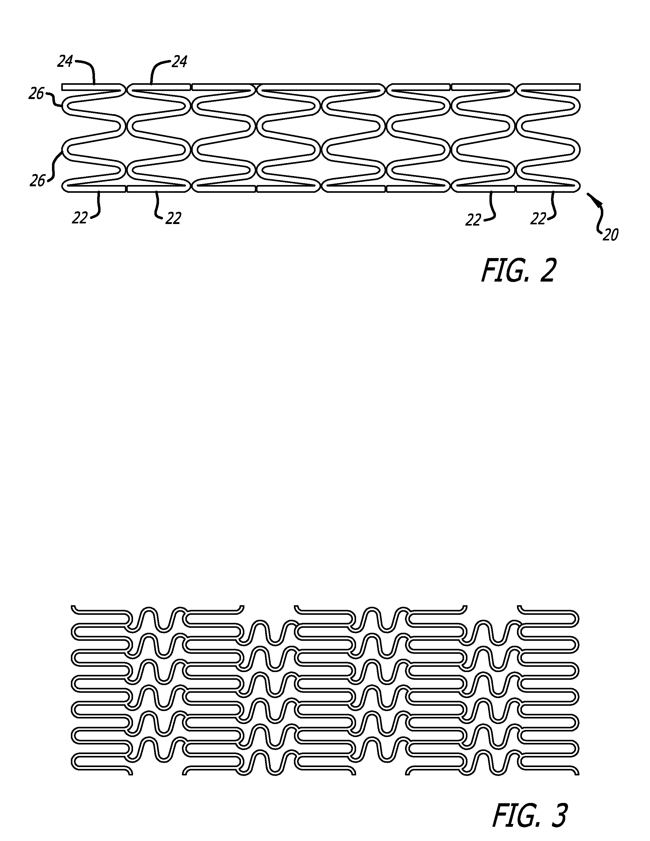 Stent Combined with a Biological Scaffold Seeded With Endothelial Cells