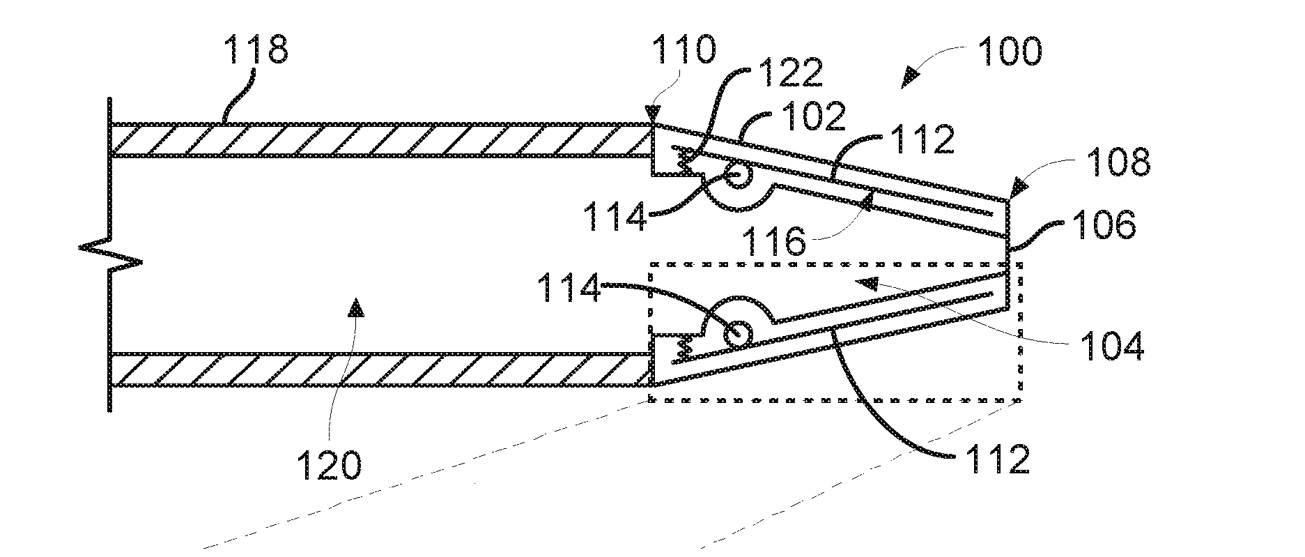 Universal Catheter Tip and Methods for Use