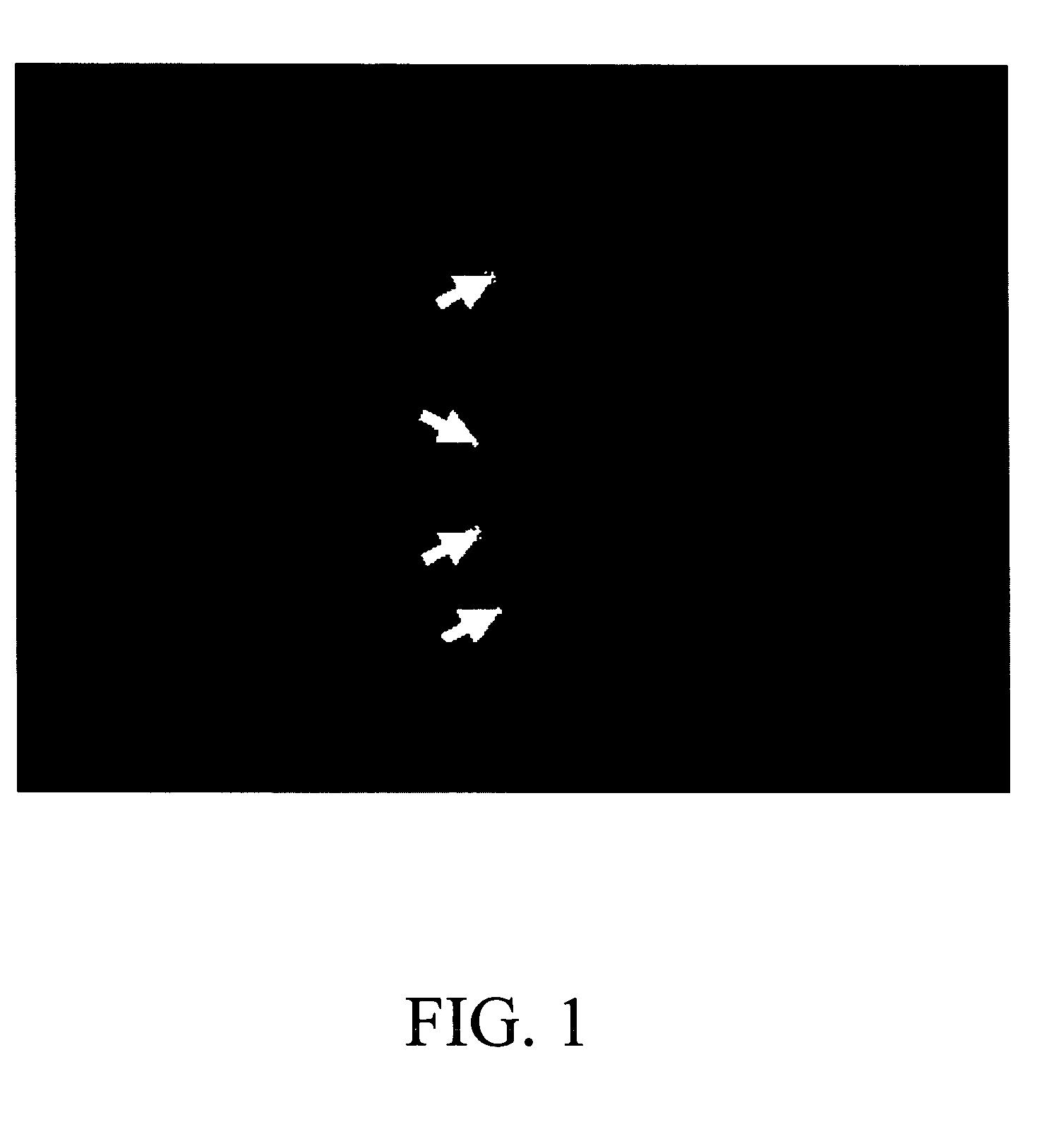 Method for virtual endoscopic visualization of the colon by shape-scale signatures, centerlining, and computerized detection of masses