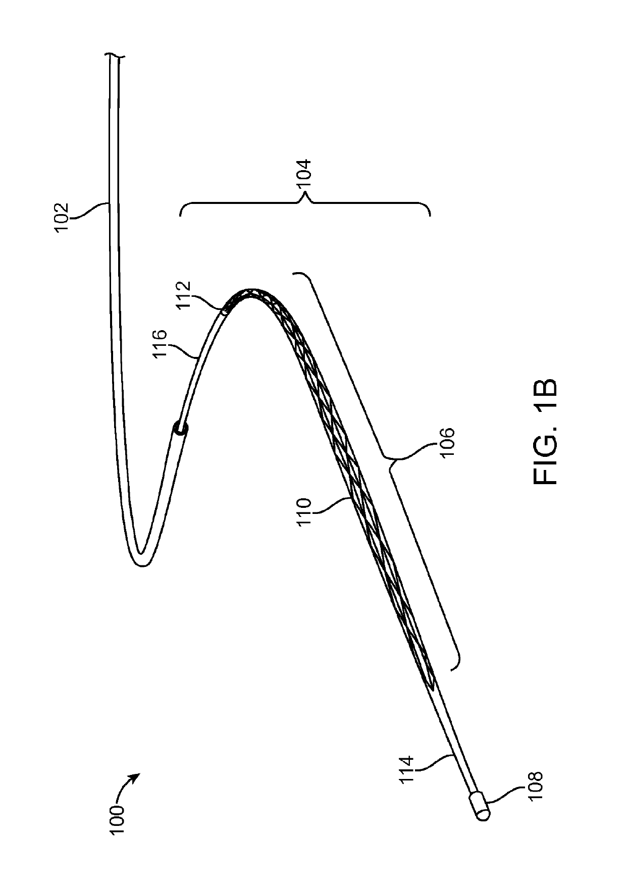 Method and apparatus for occlusion removal