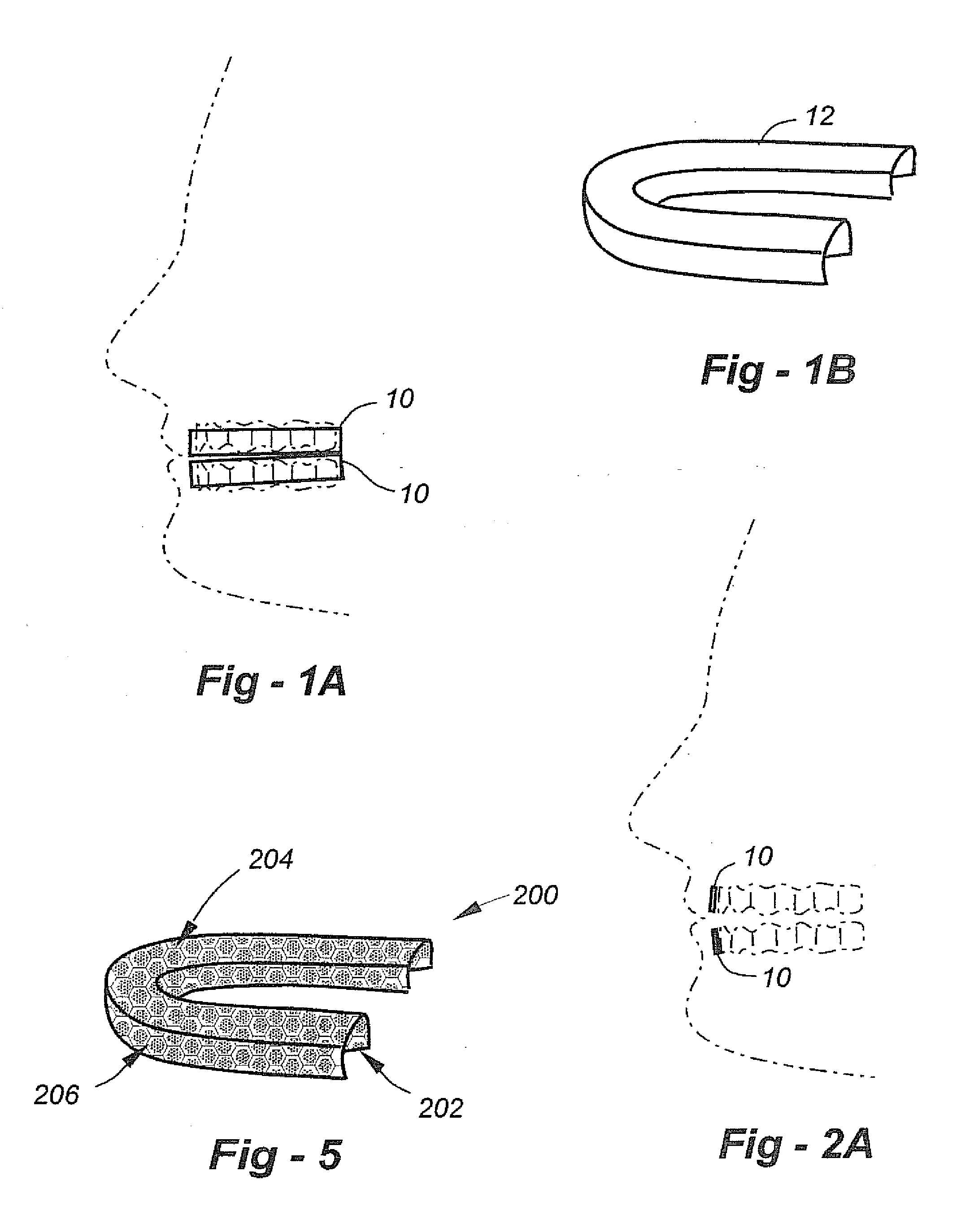 Method and apparatus for bleaching teeth