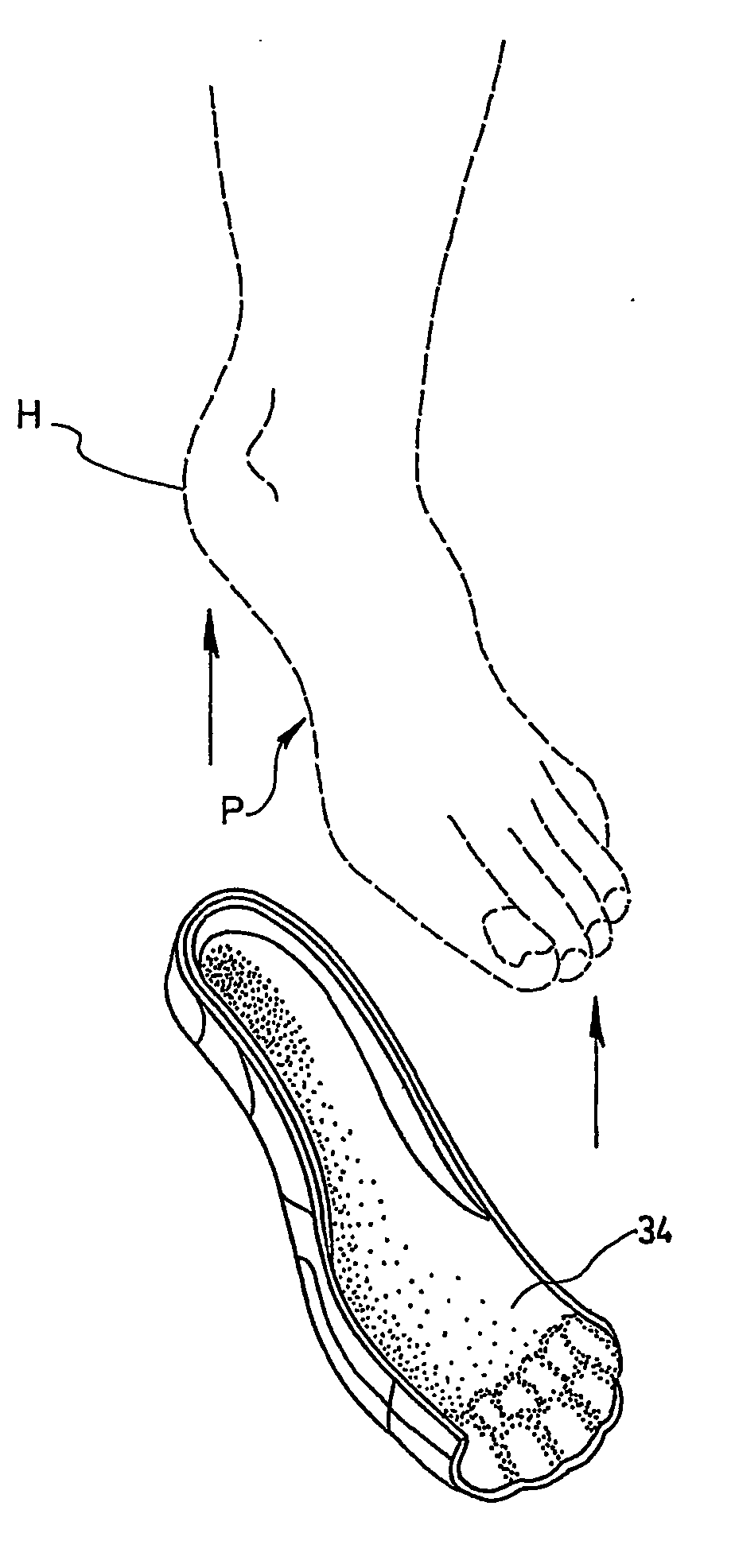 Biomechanical custom made foot orthosis and method for making the same