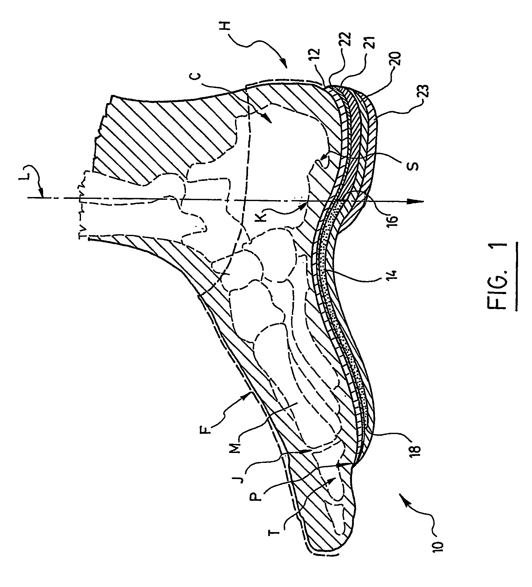 Biomechanical custom made foot orthosis and method for making the same