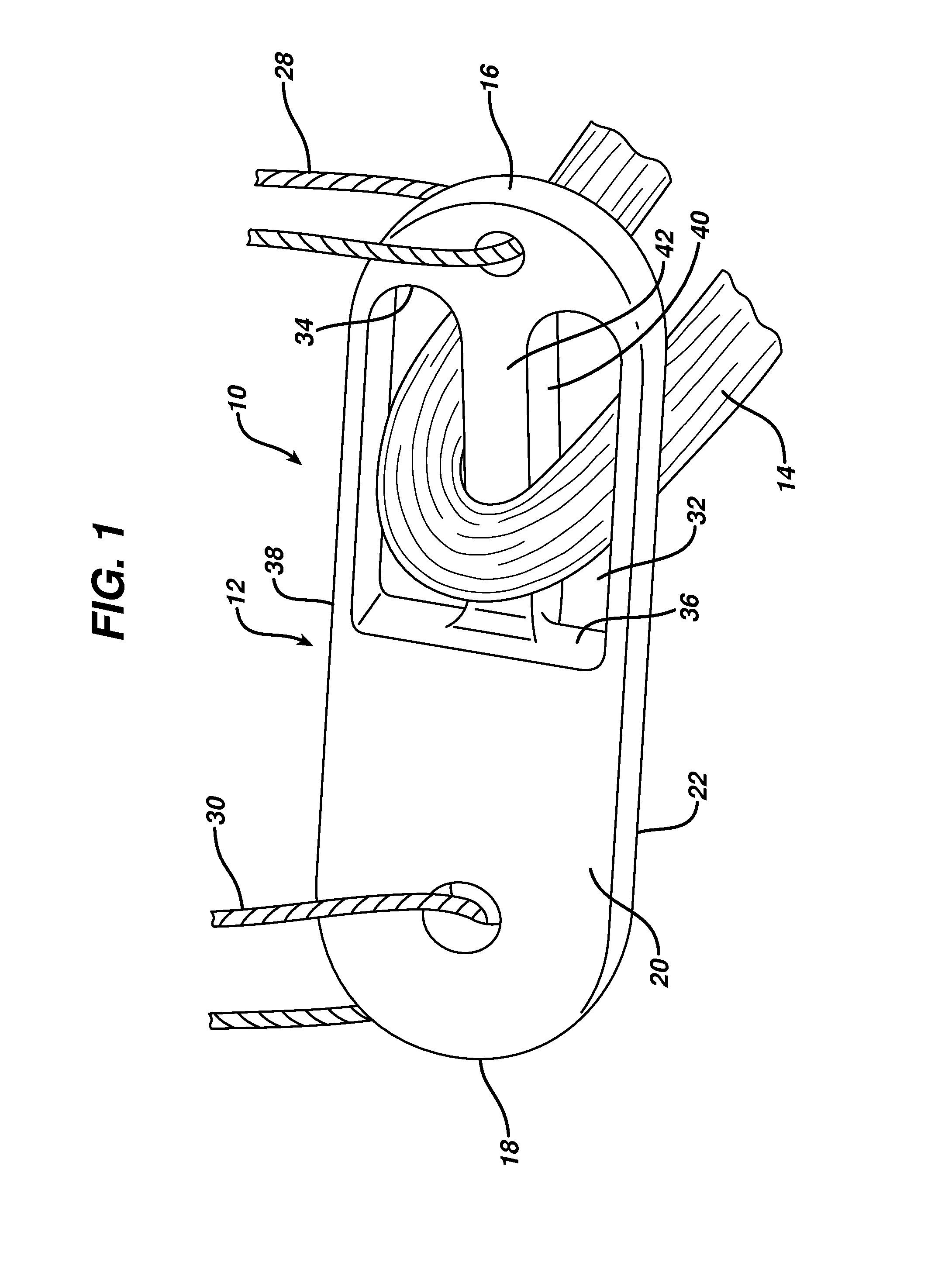 Flipping-type graft fixation device and method