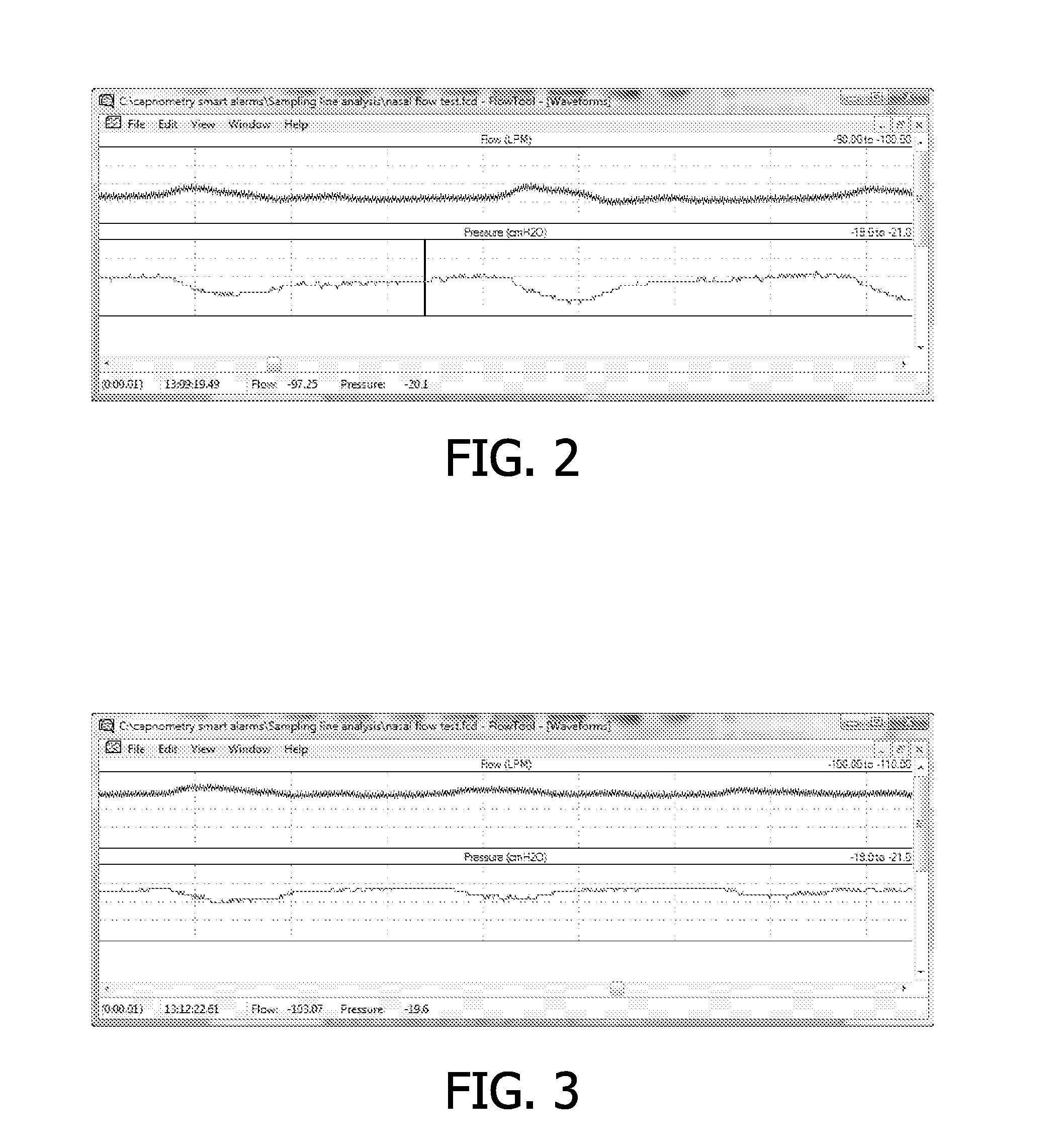 System and method of monitoring breathing