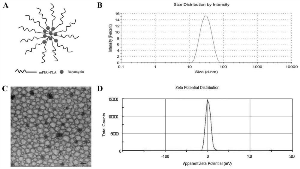 A kind of rapamycin nano-sustained-release agent and preparation method thereof