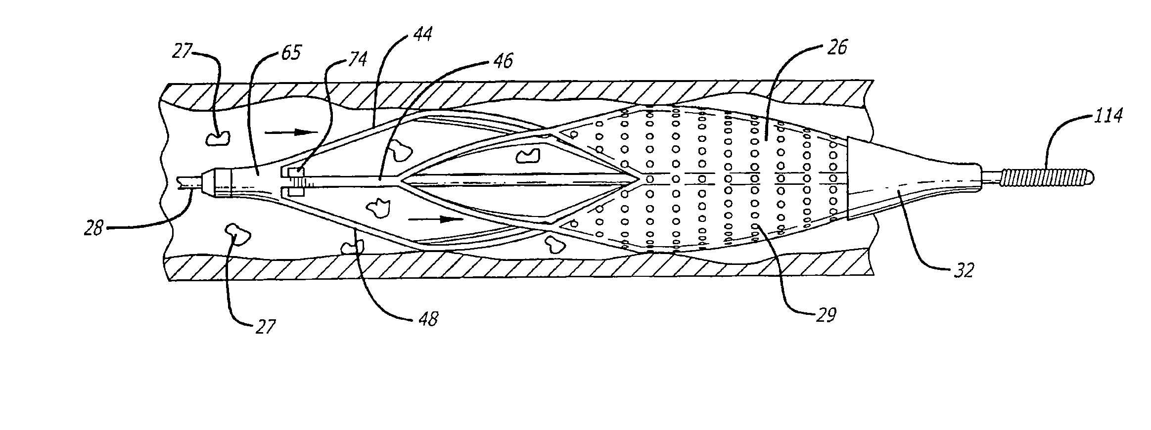 Cage and sleeve assembly for a filtering device