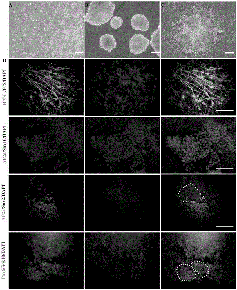 Induced differentiation method for differentiating human induced pluripotent stem cells into leydig cells and application thereof