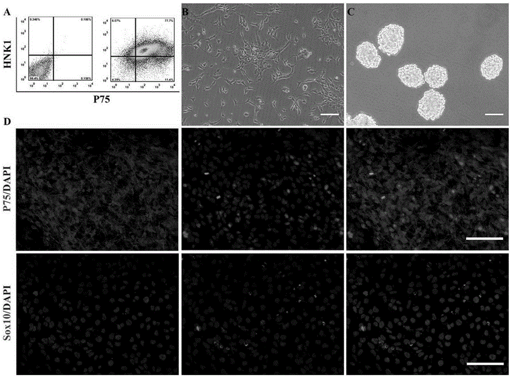 Induced differentiation method for differentiating human induced pluripotent stem cells into leydig cells and application thereof