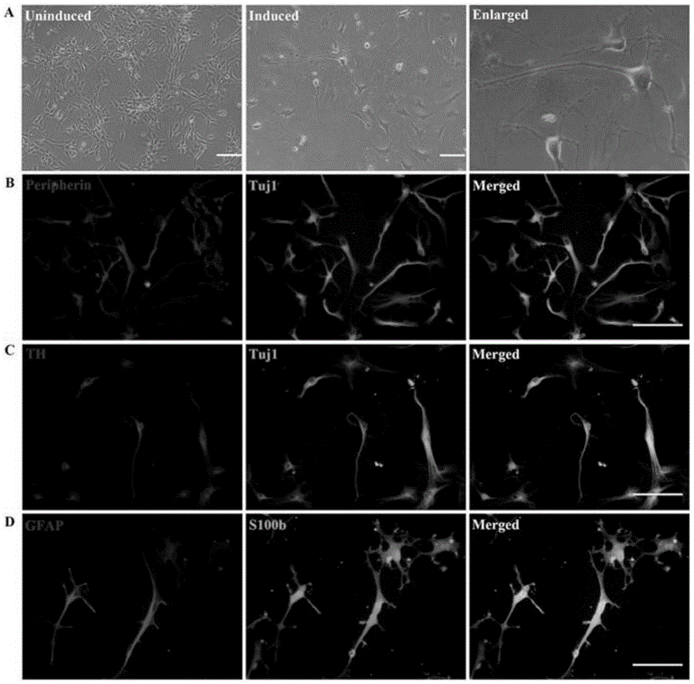 Induced differentiation method for differentiating human induced pluripotent stem cells into leydig cells and application thereof