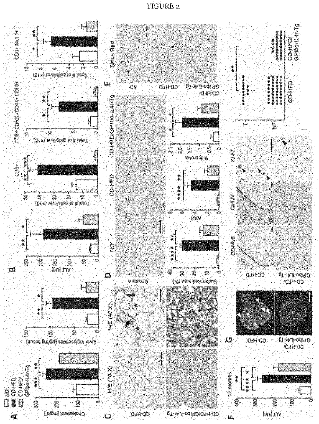 Treating non-alcoholic steatohepatitis (NASH) and hepatocellular carcinoma (HCC) with compounds binding the ectodomain of platelet glycoprotein ib (GPIB) alpha