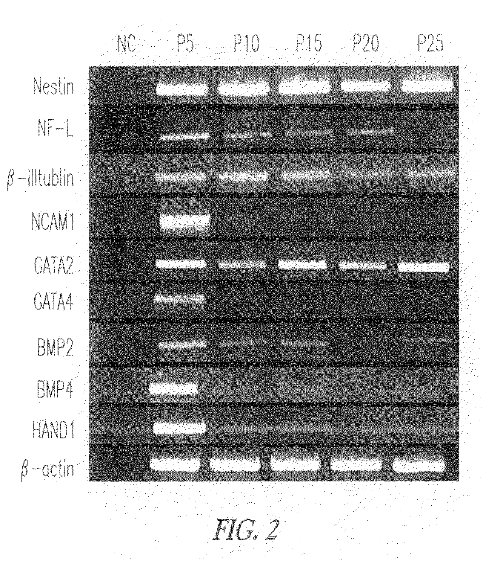 Xeno-free culture conditions for human embryonic stem cells and methods thereof