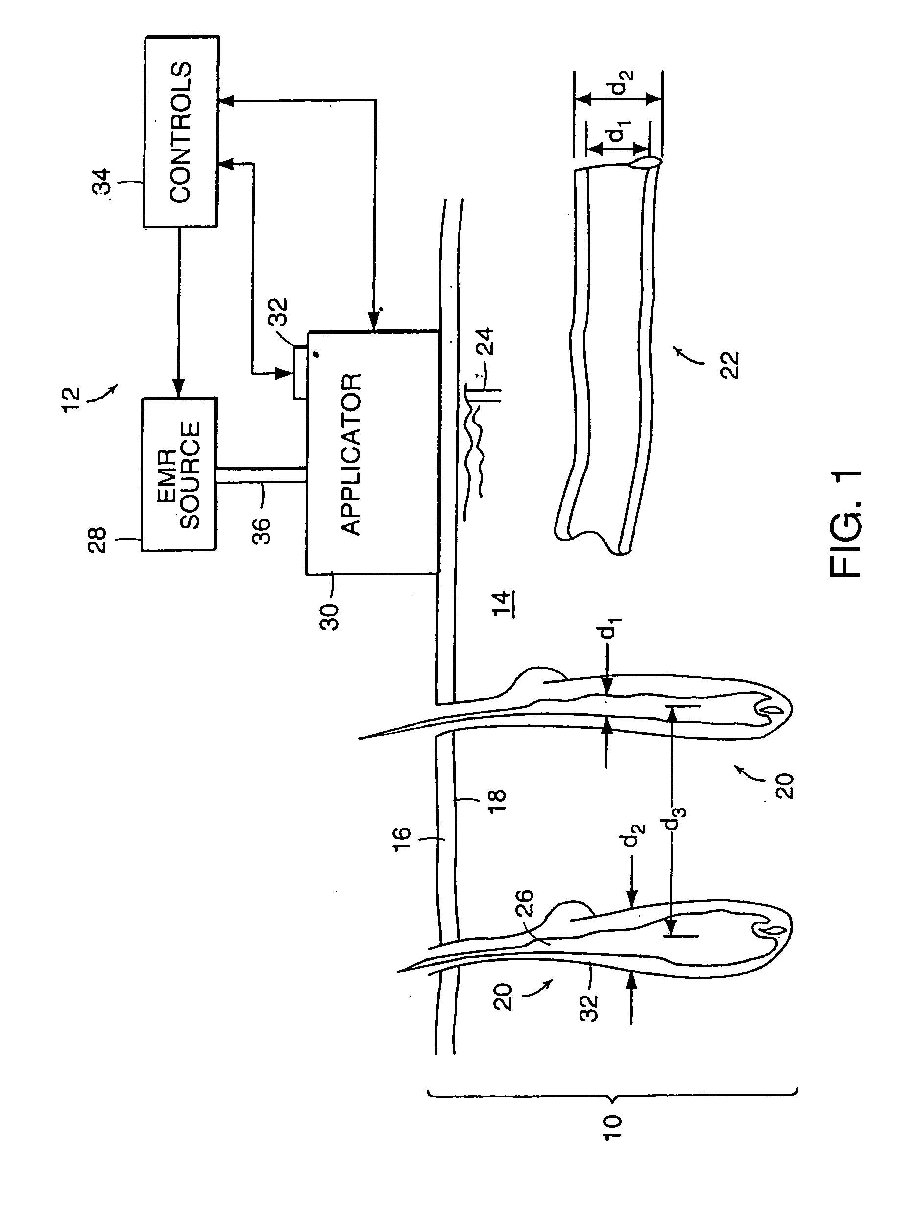 Method and Apparatus for Medical Treatment Utilizing Long Duration Electromagnetic Radiation