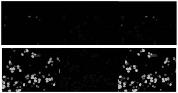 Head and neck squamous cell carcinoma treatment molecular probe and application