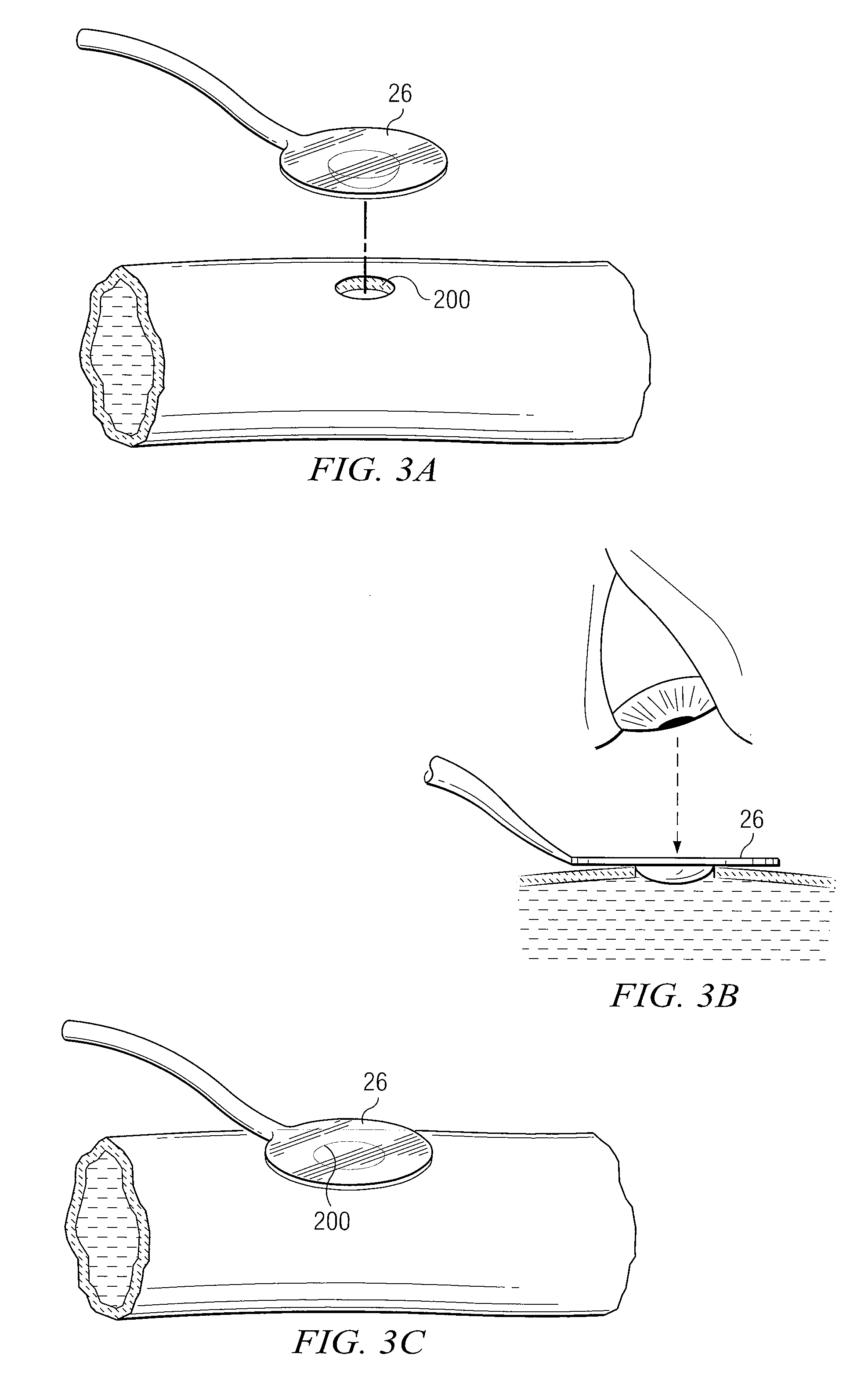 System and Method for Providing an Obturator for Enhanced Directional Capabilities in a Vascular Environment