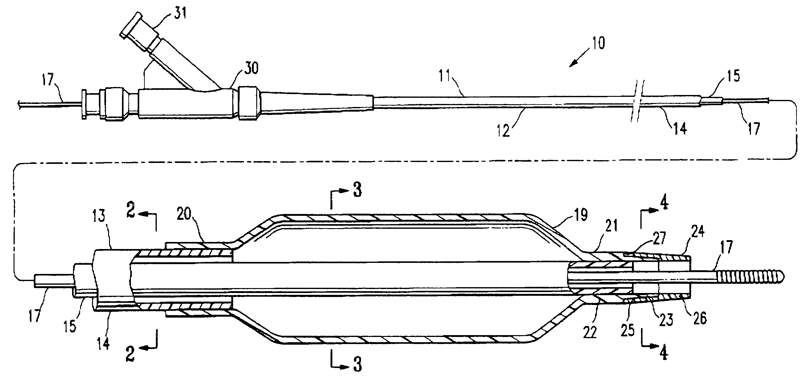 Balloon catheter having a balloon distal skirt section with a reduced outer diameter secured to a soft distal tip member