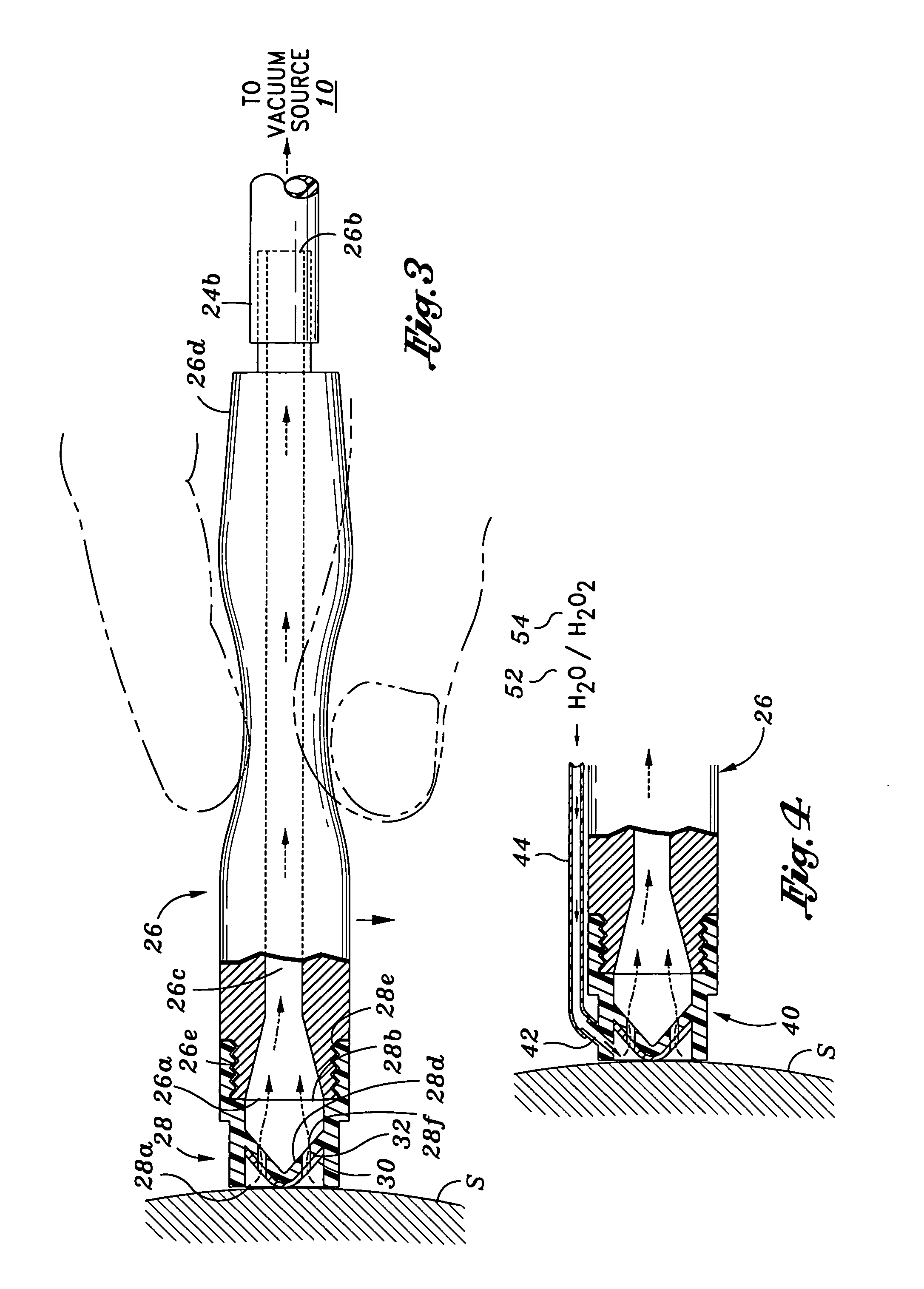 Hydro-dermabrasion apparatus and method of use