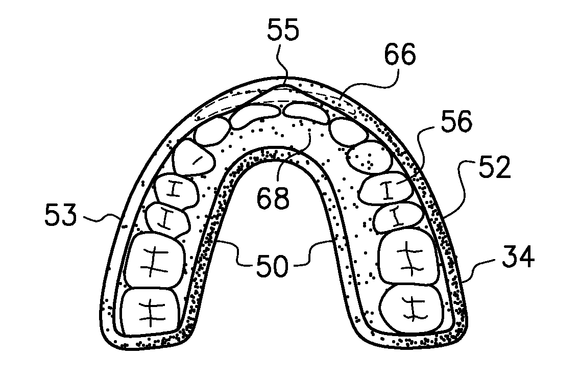 Mouthguard and method of manufacture therefor