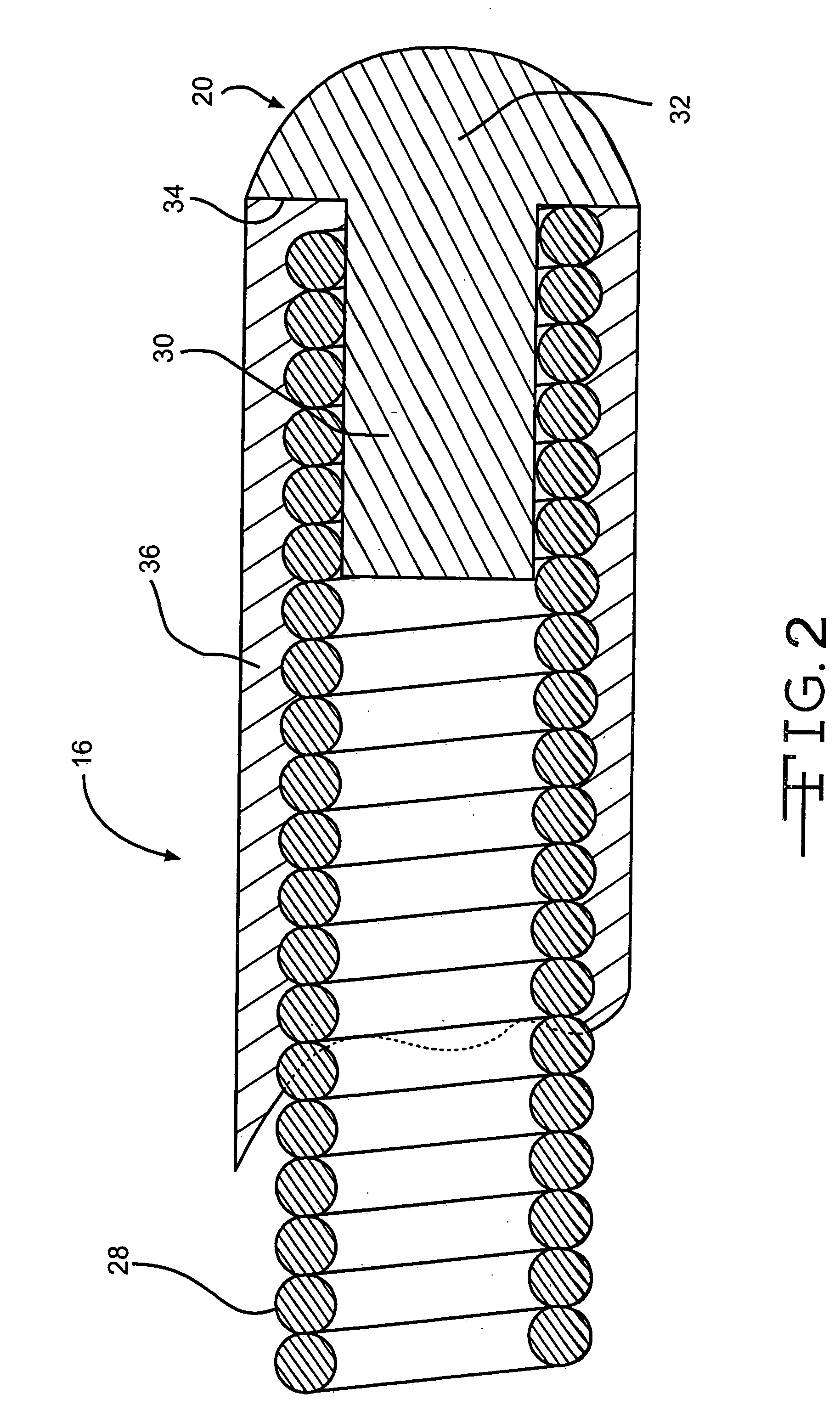 Implantable electrical lead wire