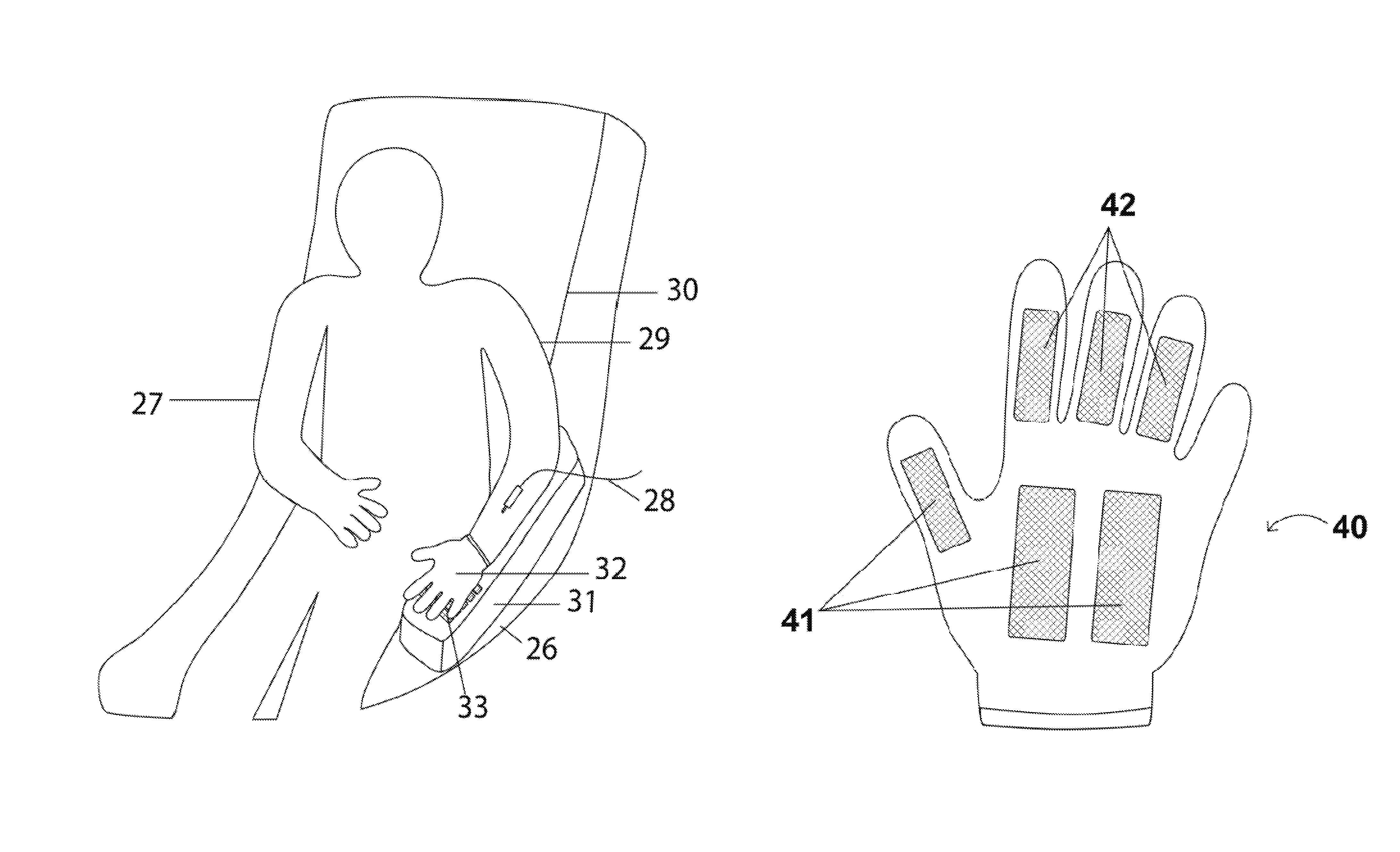Support and stabilization device for dialysis treatment