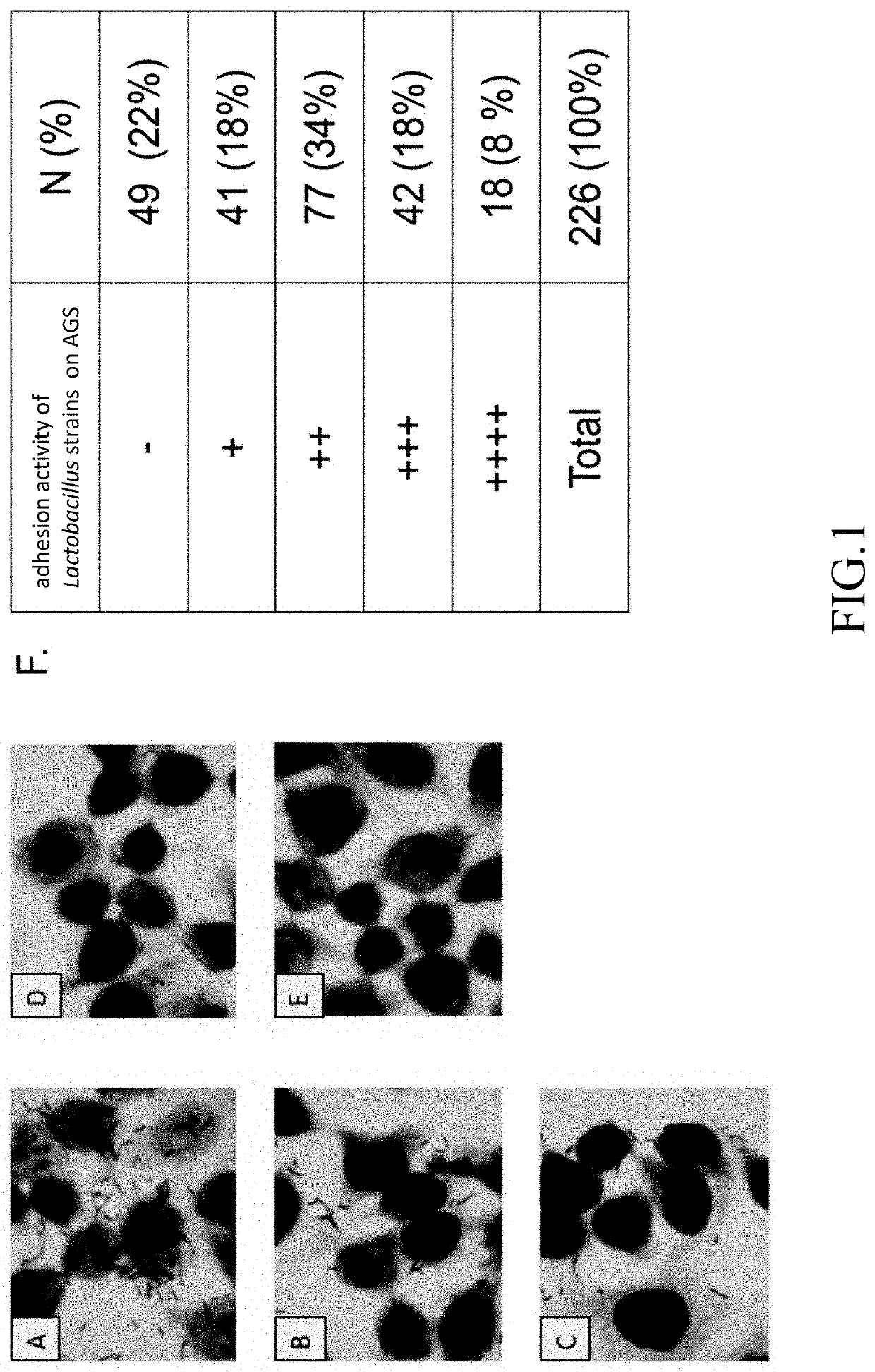 Lactobacillus composition for inhibiting gastritis induced by gastric helicobacter pylori and use thereof