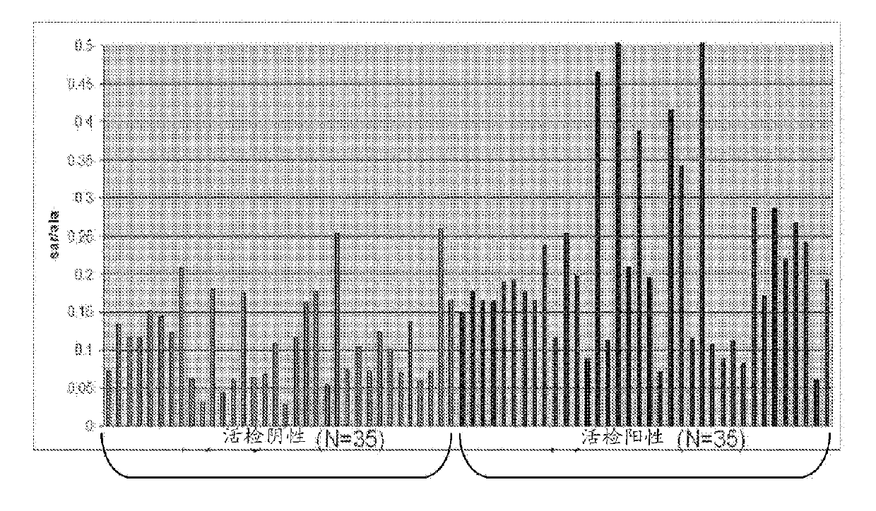 Metabolomic profiling of prostate cancer