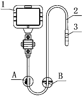 Prostate operation endoscope