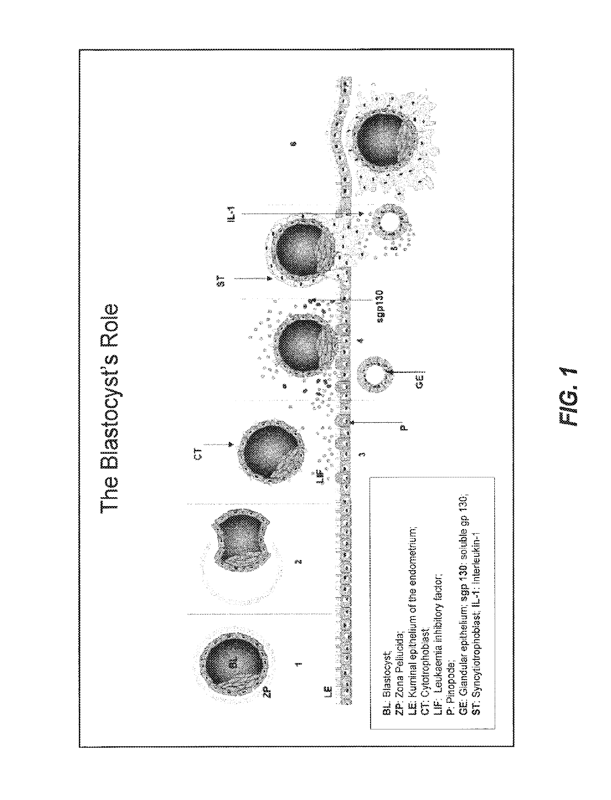 Secretome profile-facilitated in vitro fertilization