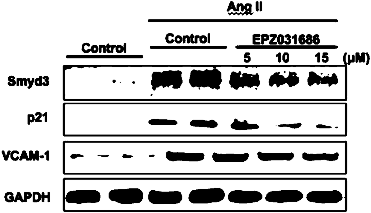 Application of compound EPZ031686 in preparing drug for treating vascular aging related diseases