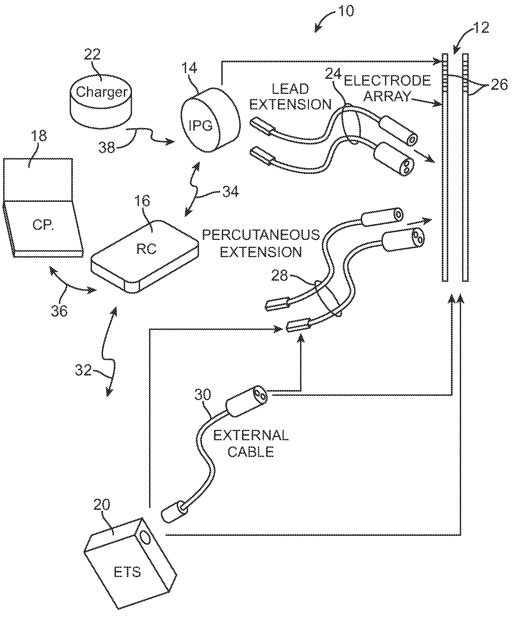 Methods to avoid frequency locking in a multi-channel neurostimulation system using pulse placement