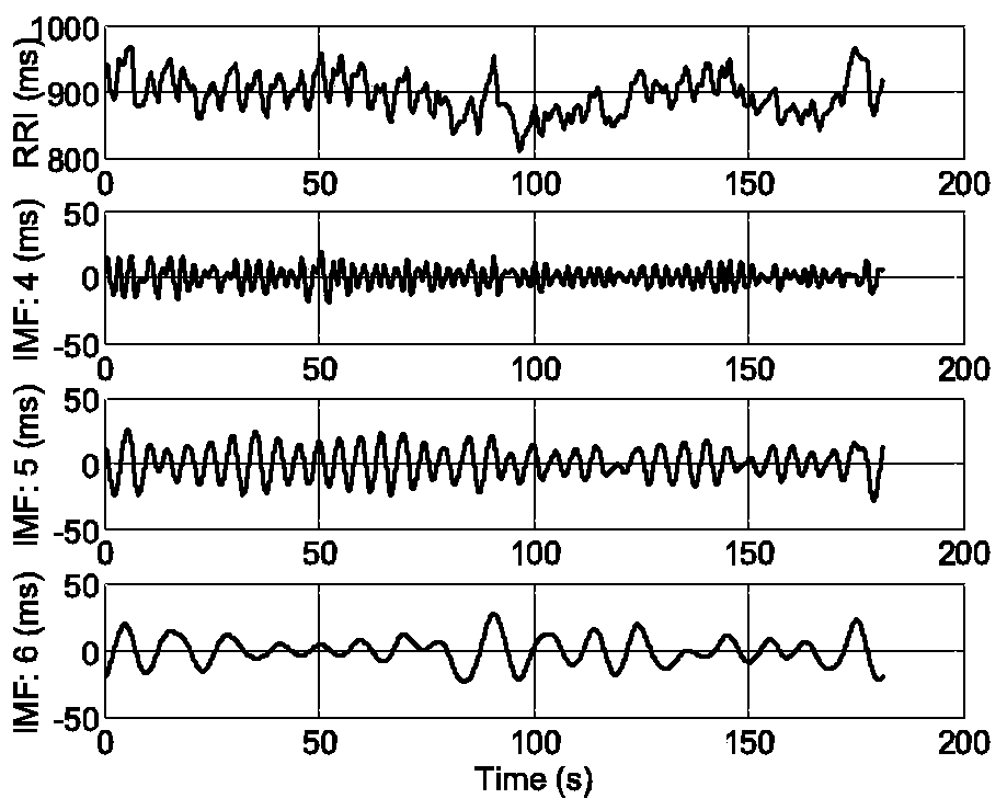 Cardiopulmonary Coupling Analysis Method Based on Single Lead ECG