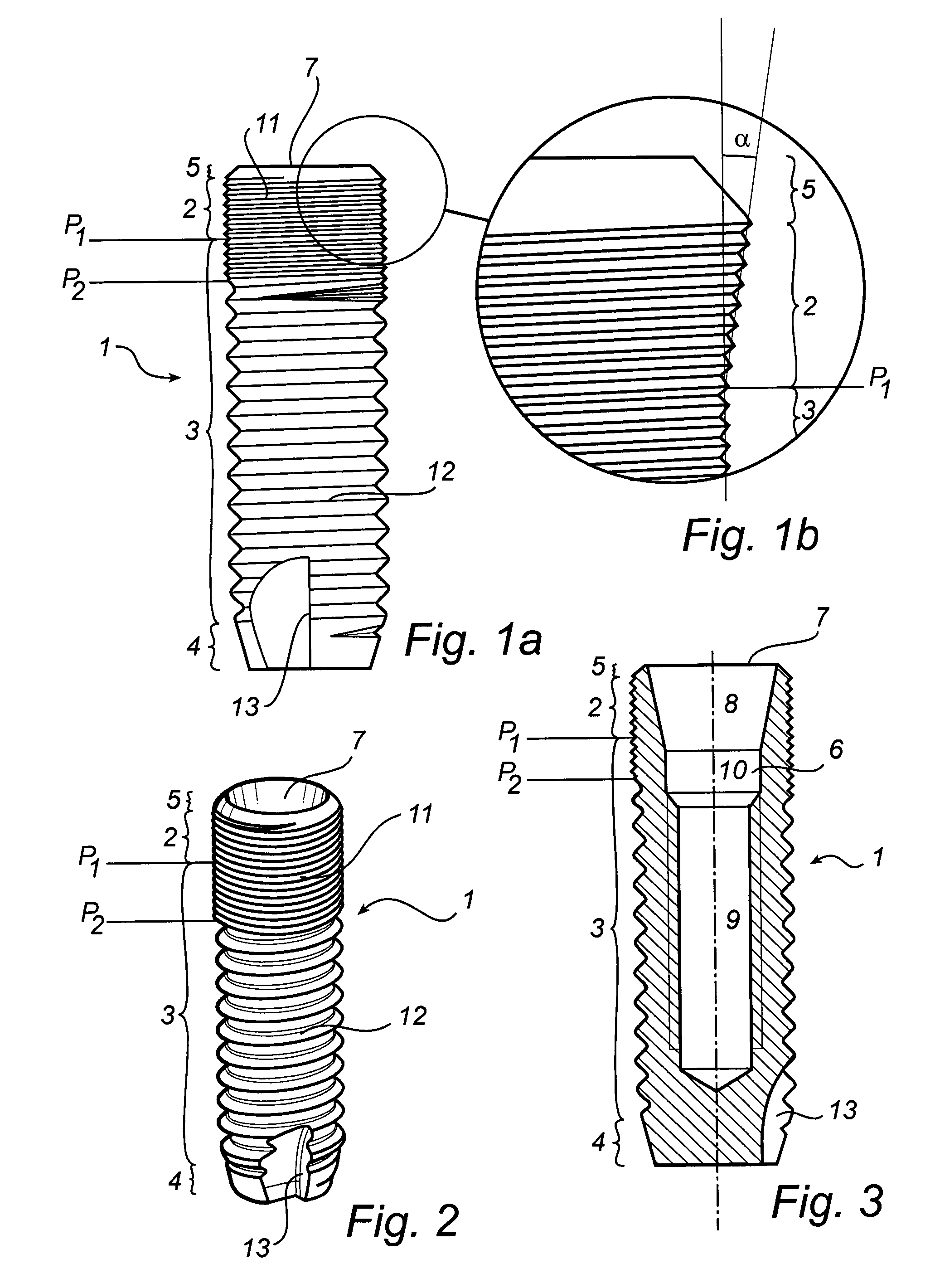 Implant, arrangement comprising an implant, and method for inserting said implant in bone tissue