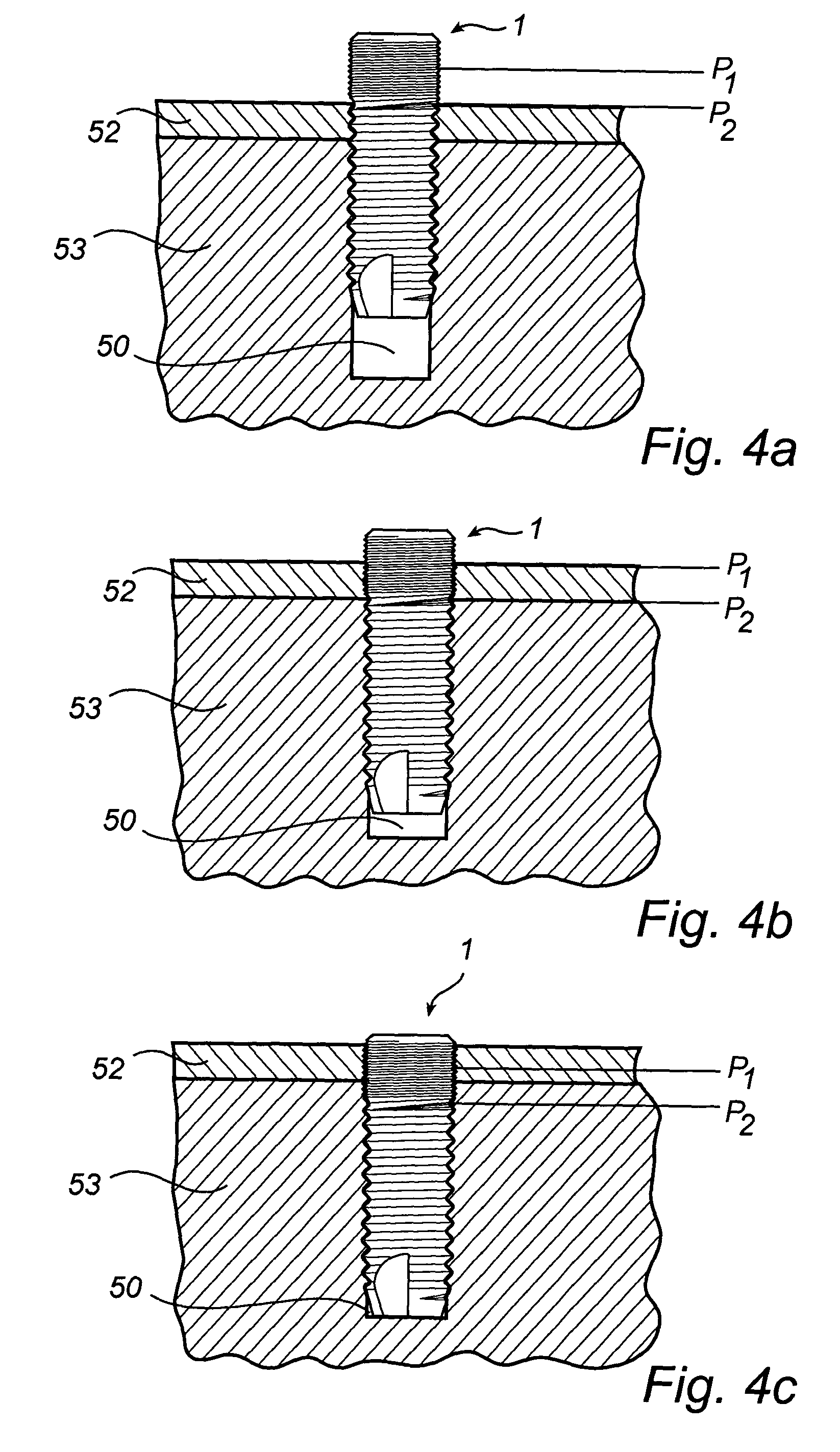 Implant, arrangement comprising an implant, and method for inserting said implant in bone tissue