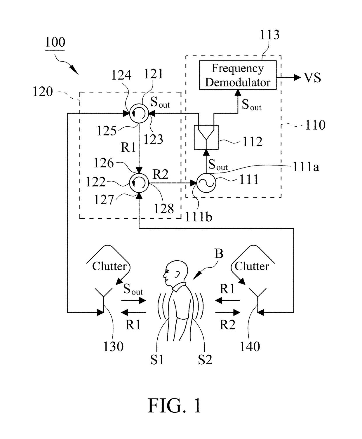 Vital sign detection system with random body movement cancellation