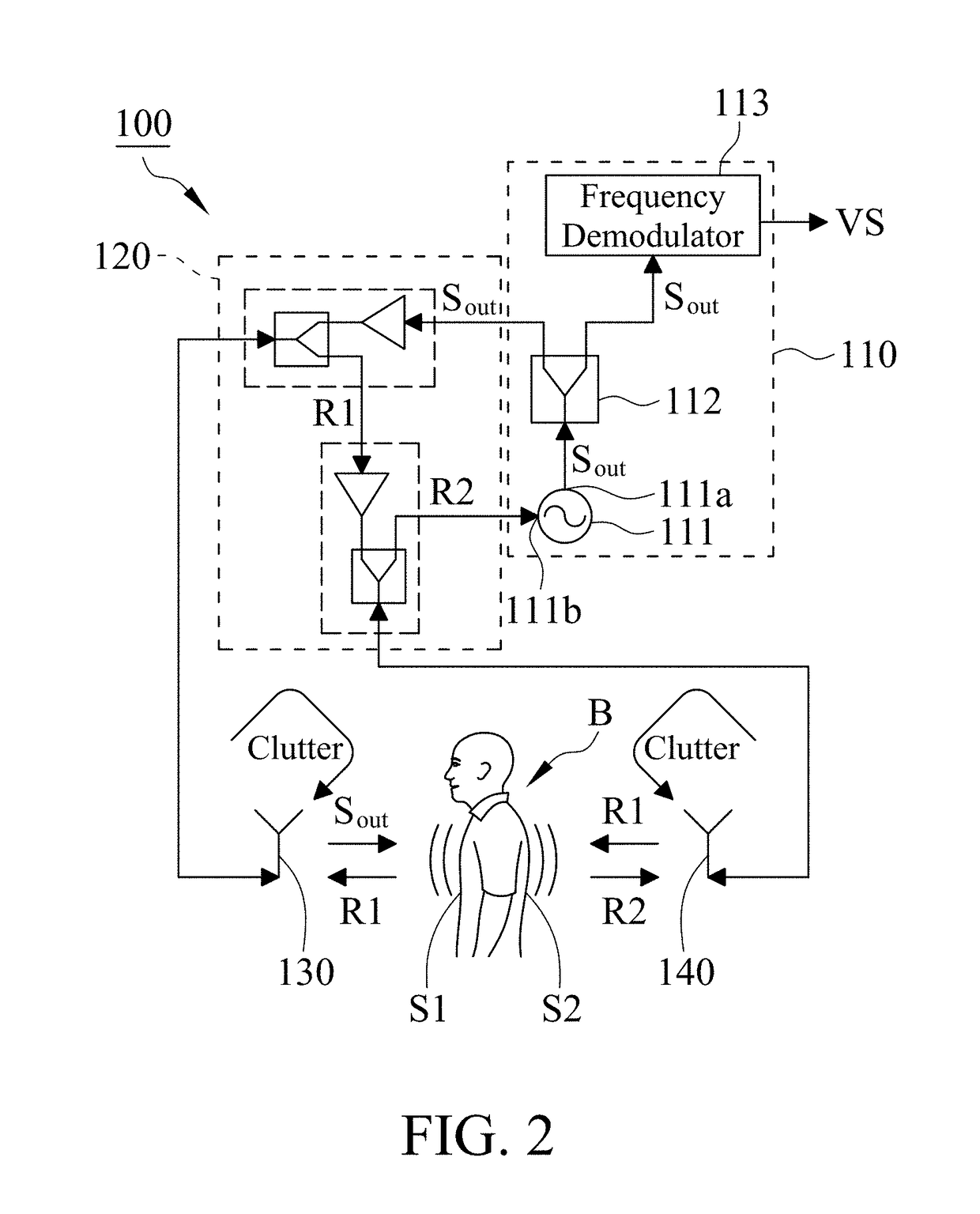 Vital sign detection system with random body movement cancellation