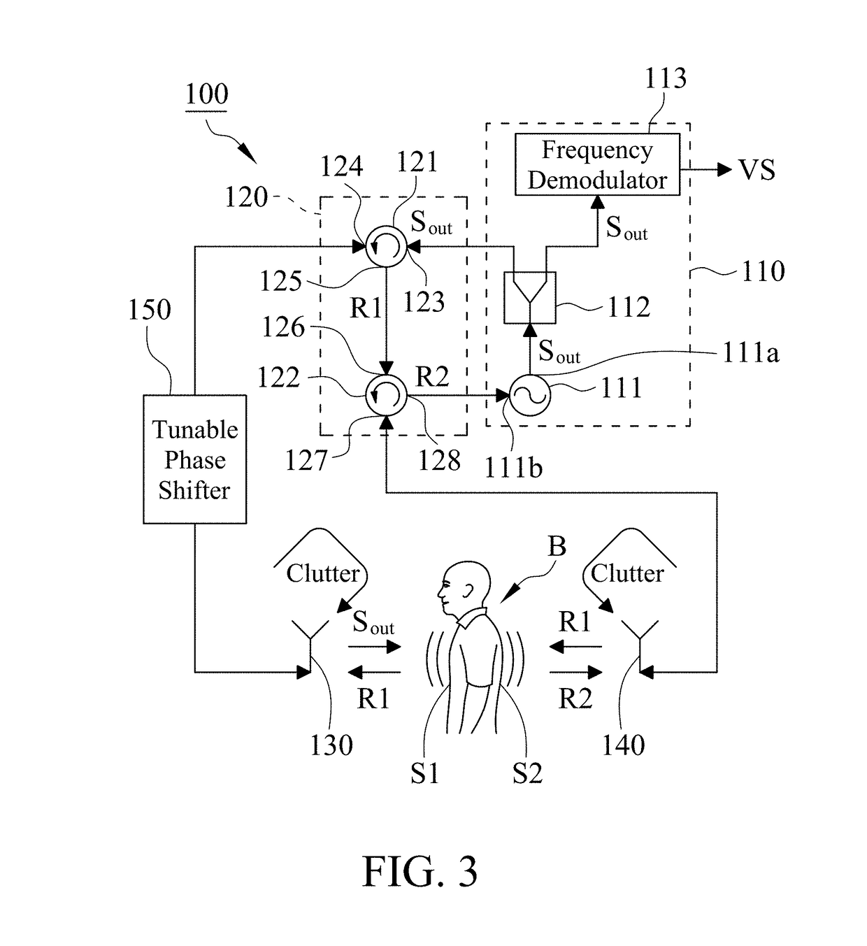 Vital sign detection system with random body movement cancellation