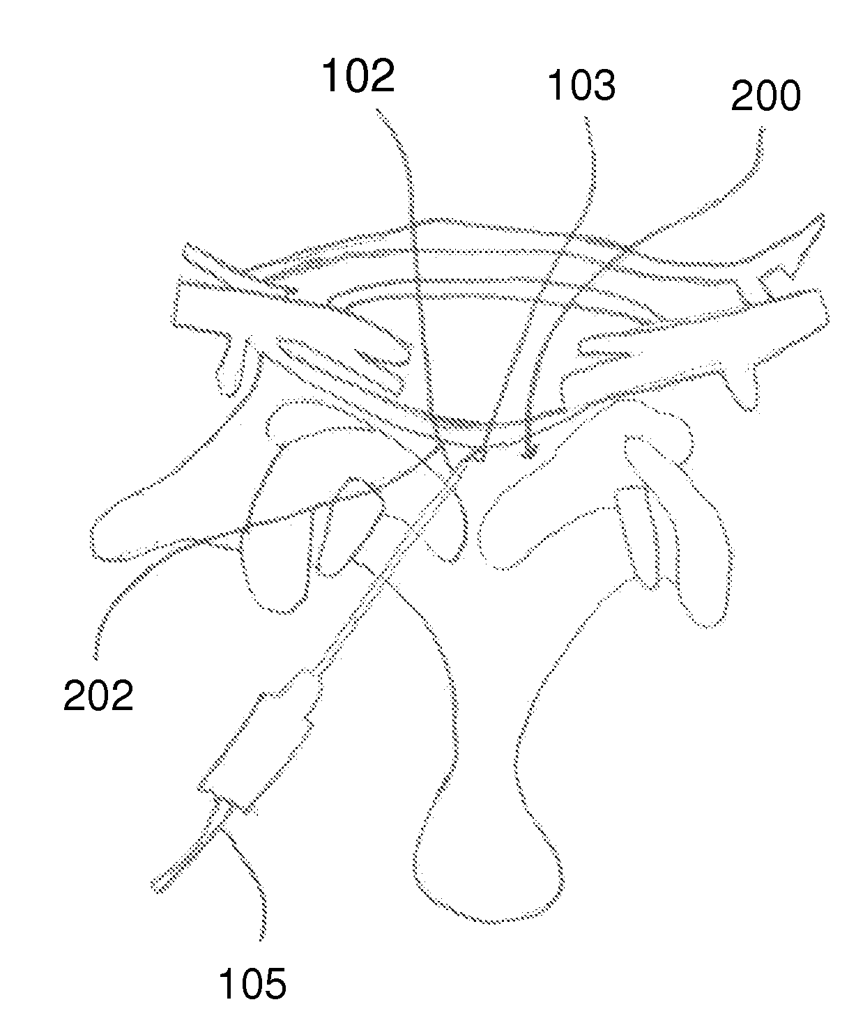 Methods and Apparatus for Applying Energy to Patients