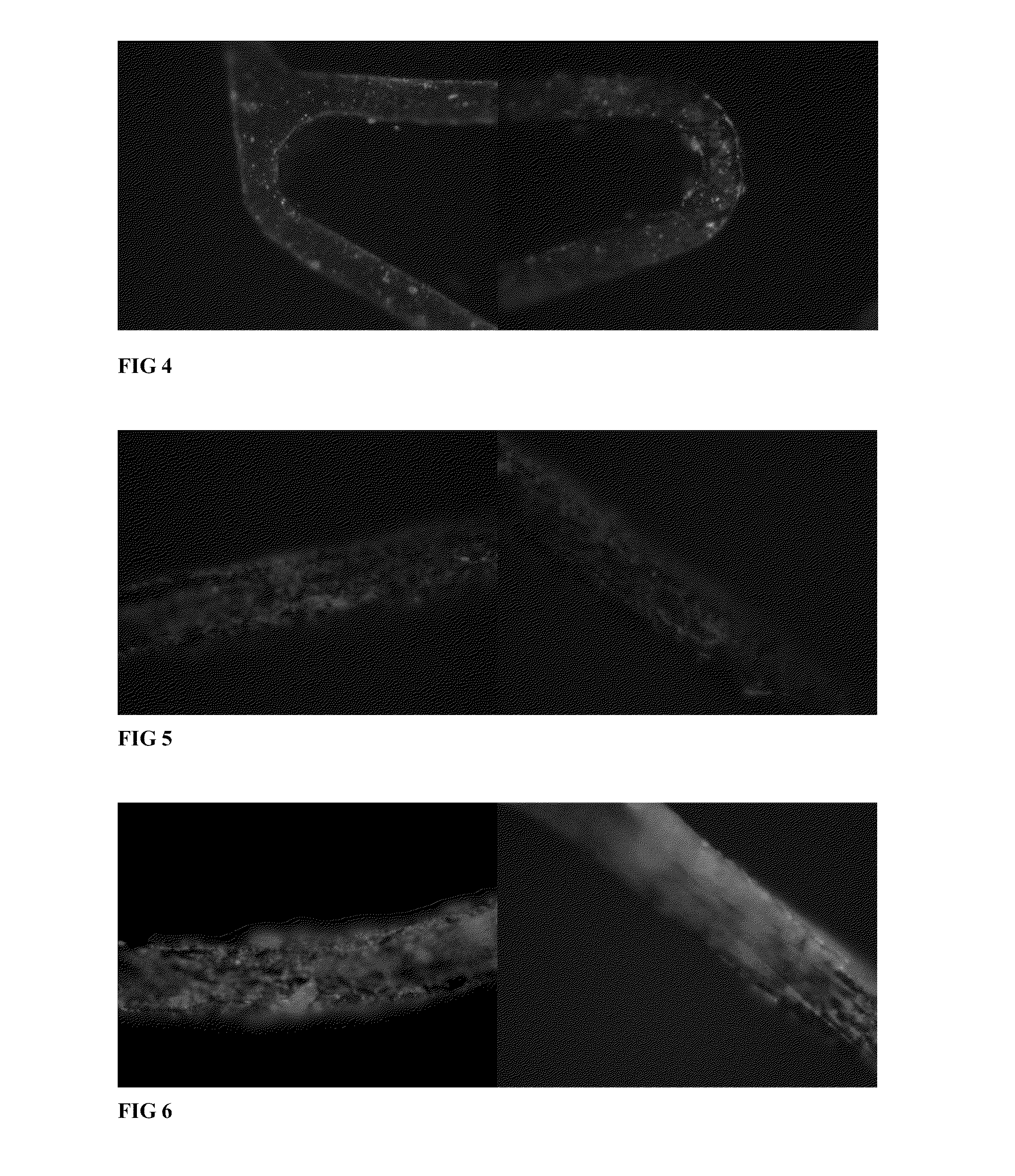 Blood vessel stent of amidoglucosan polysaccharide loaded with cd133 antibody and its preparation method