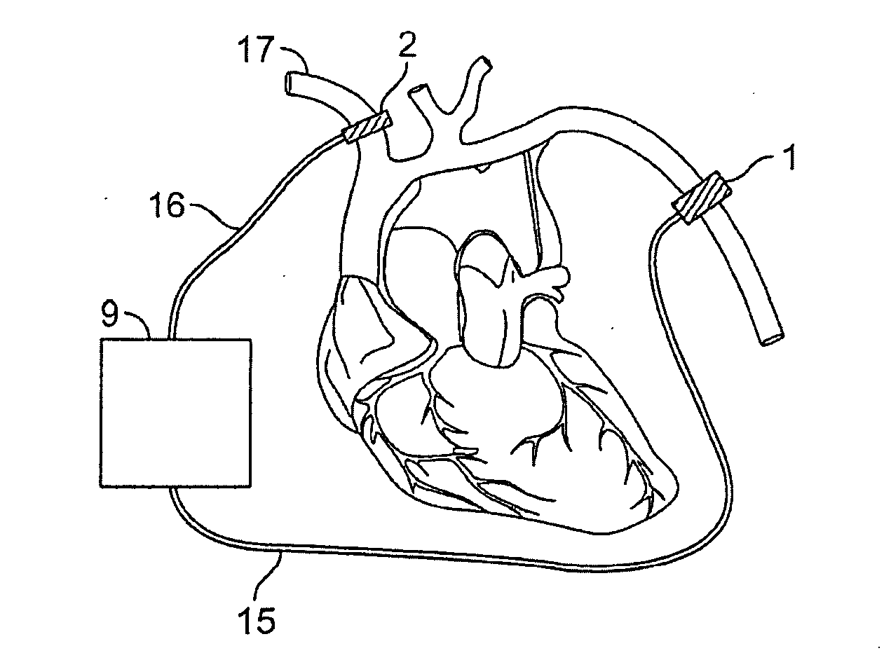 Methods and devices for counteracting hypotension