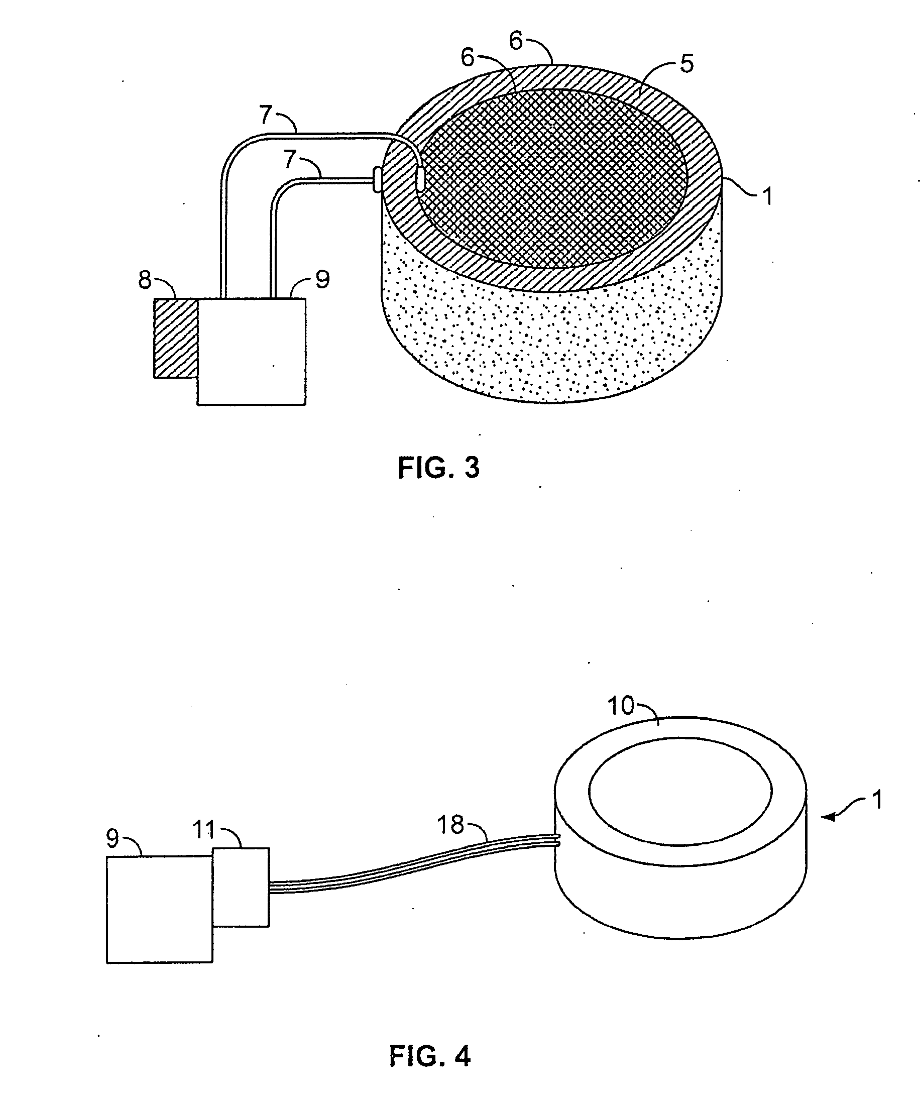 Methods and devices for counteracting hypotension