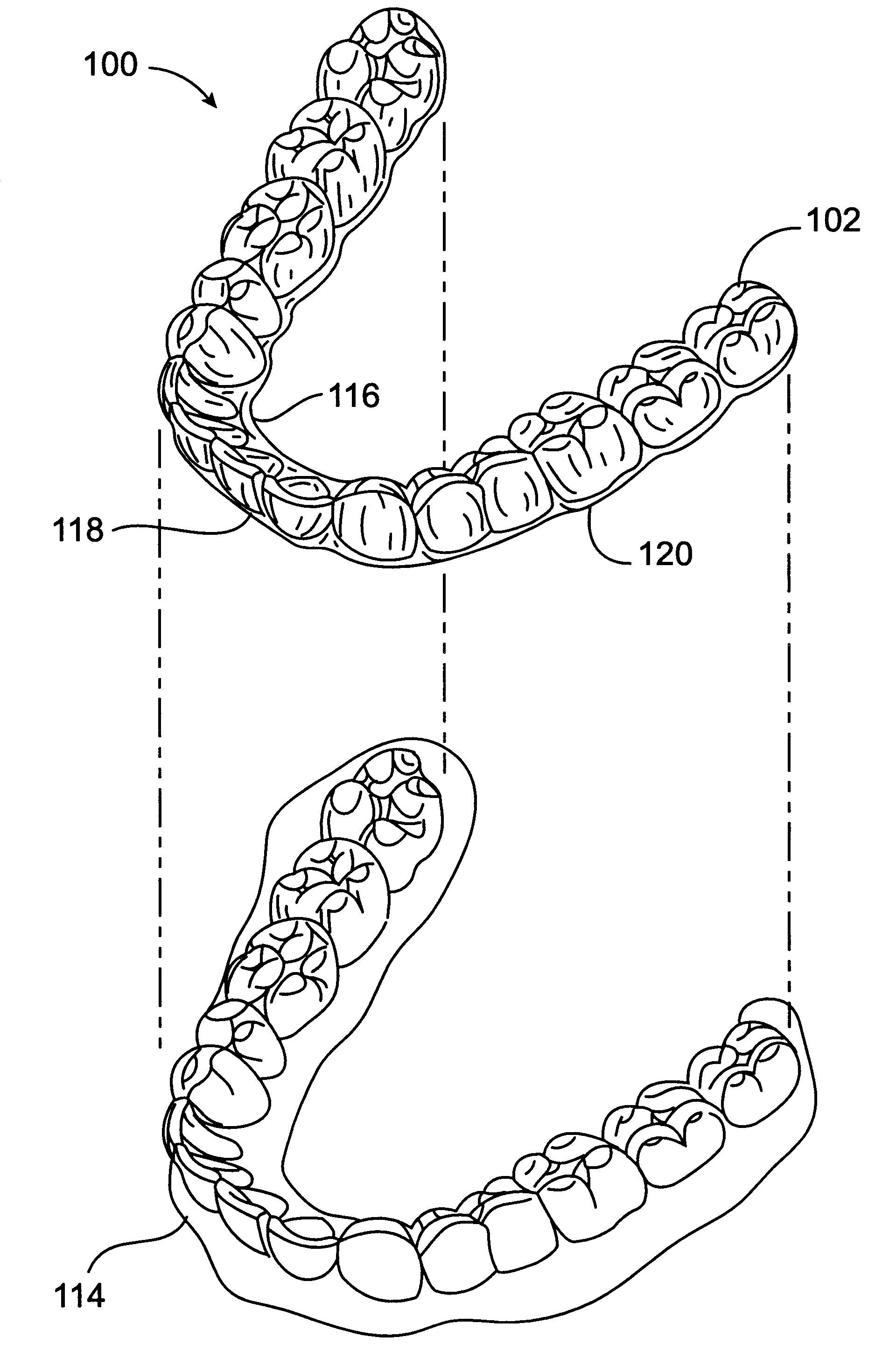 System and method for releasing tooth positioning appliances