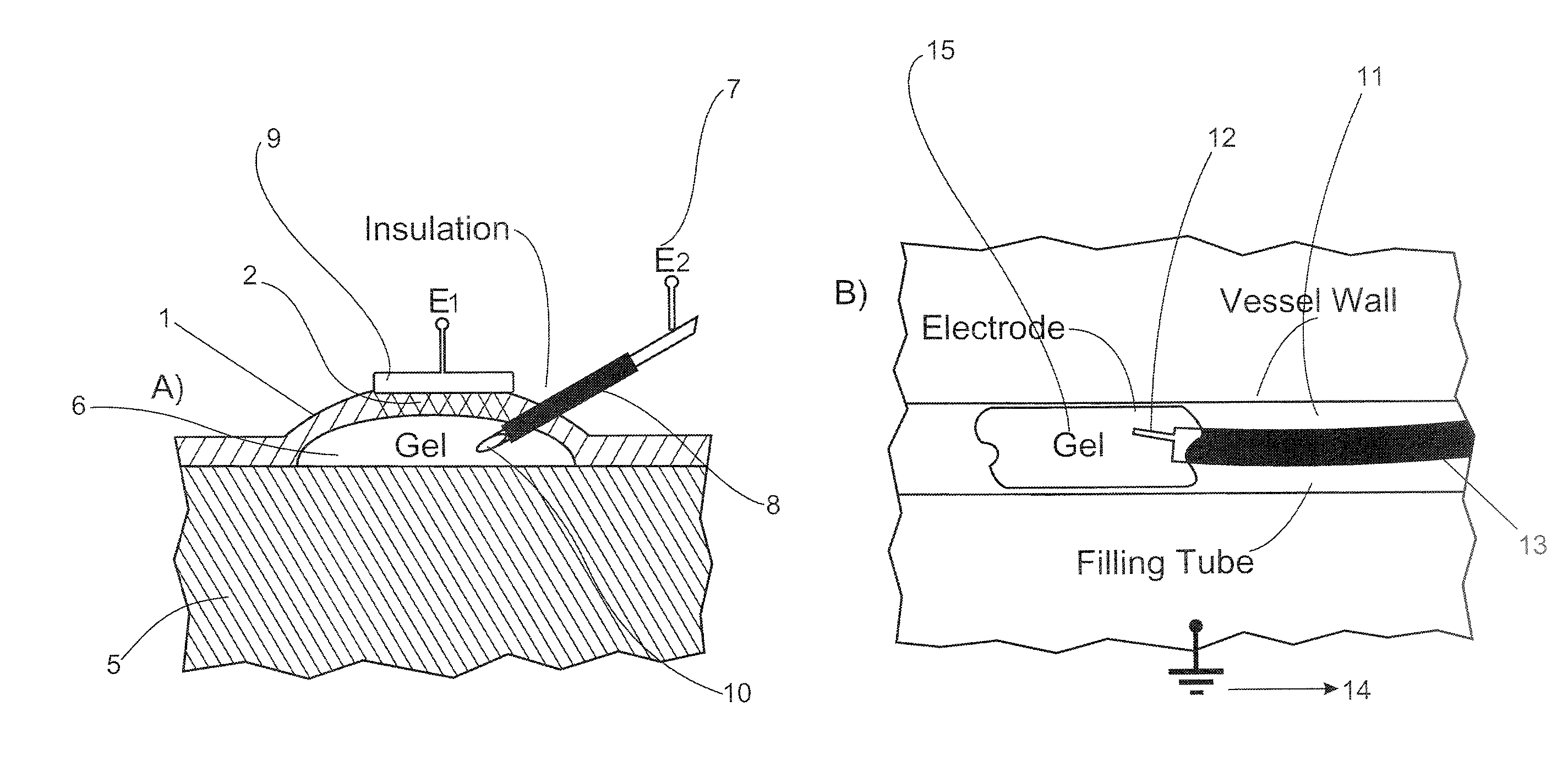Gels with predetermined conductivity used in electroporation of tissue