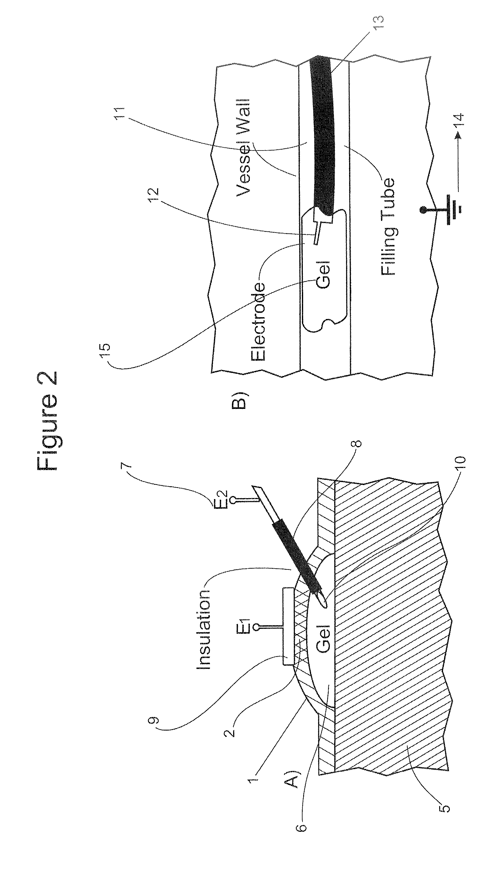 Gels with predetermined conductivity used in electroporation of tissue
