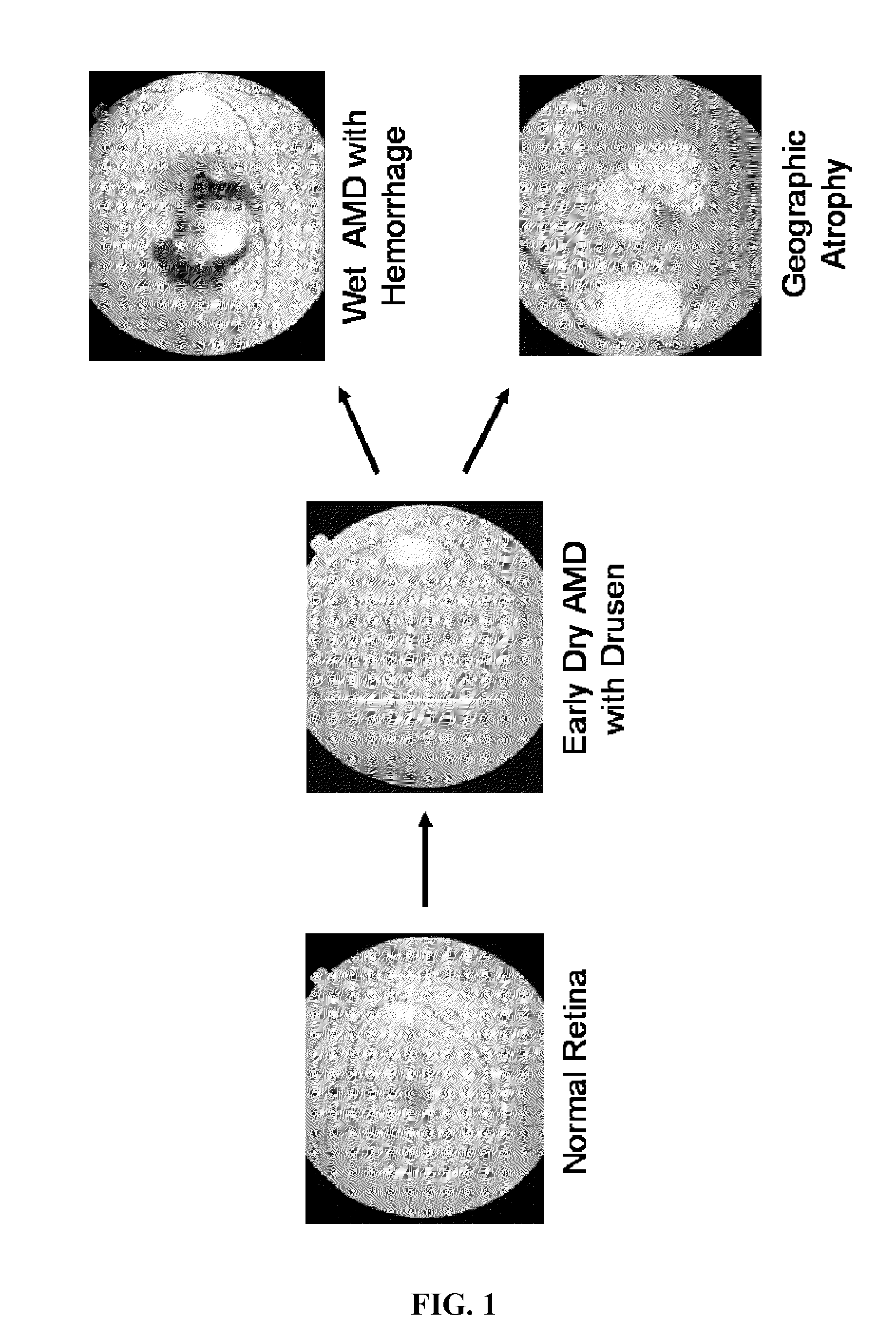 Treatment of diseases characterized by inflammation